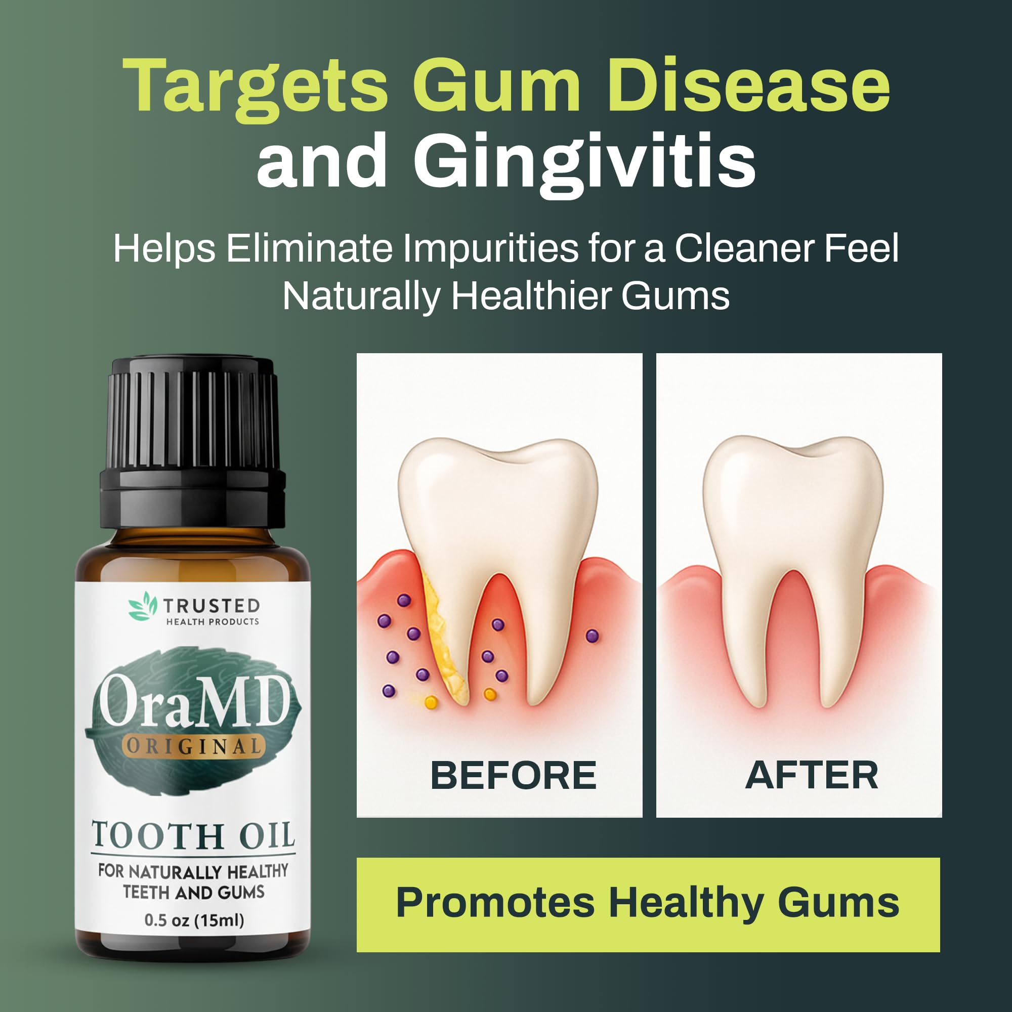 OraMD 4-in-1 Original Tooth Oil | Gum Disease Treatment