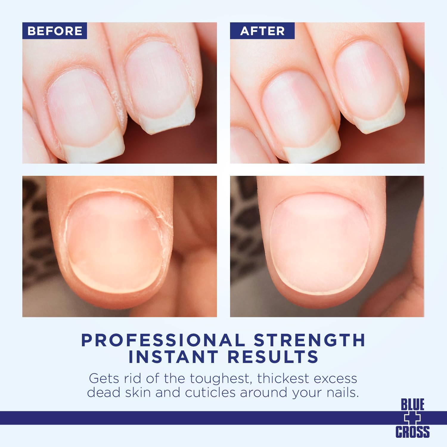 Blue Cross Cuticle Remover Cream for Dry Damaged Cuticles, Made in USA, 2oz