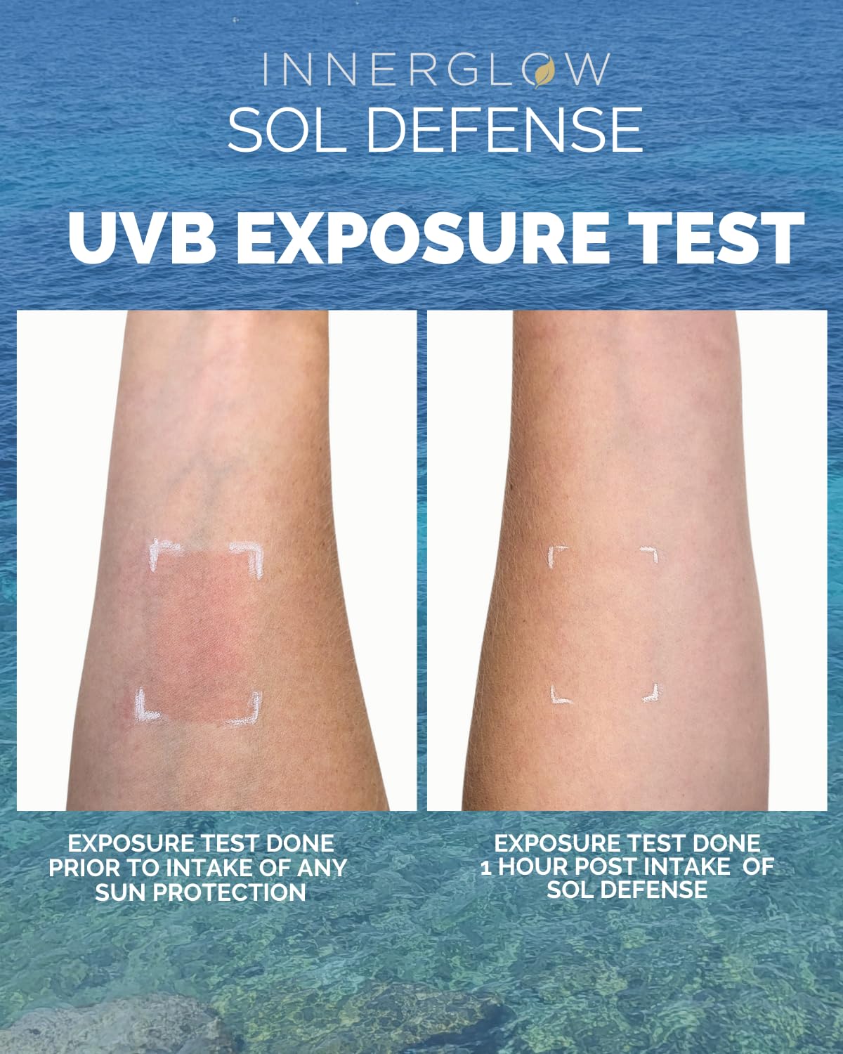 Inner Glow Sol Defense Gummies – Dermatologist & Plastic Surgeon-Formulated Skin Resilience Vitamin Supplement with Poly