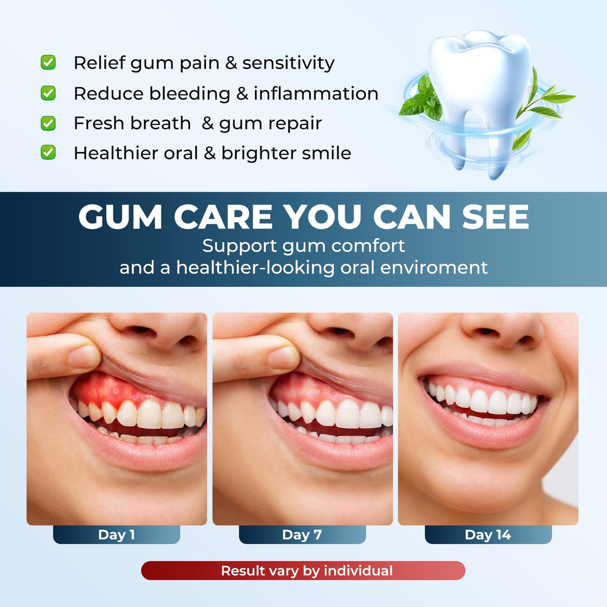 Red Light Therapy for Gums KTS Oral Care Light with Smart - KTS Official Imagery - 5