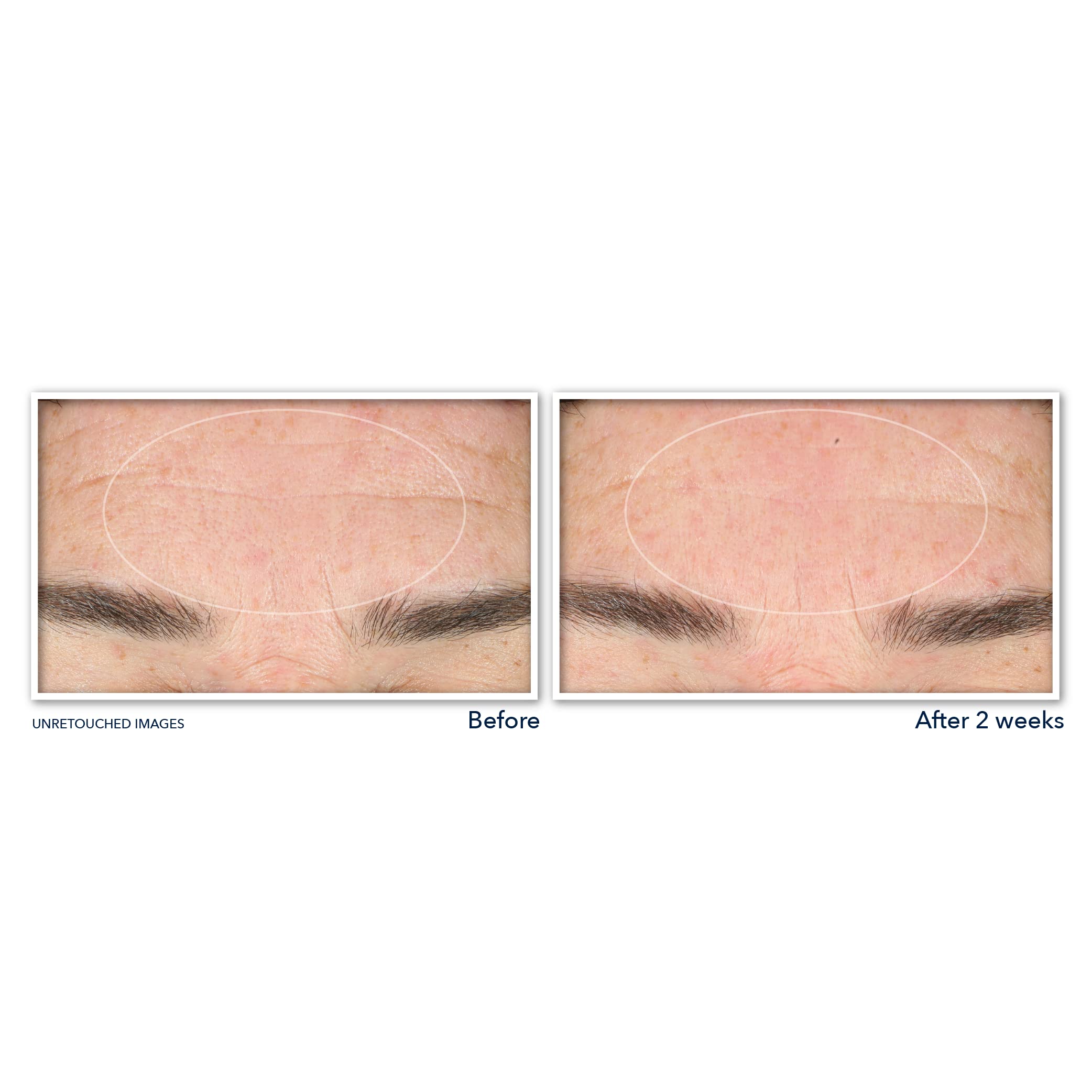 RoC Derm Correxion Facial Cleanser with Niacinamide and Amino Acids, a skin cleansing agent with a gel texture and gentle formula.