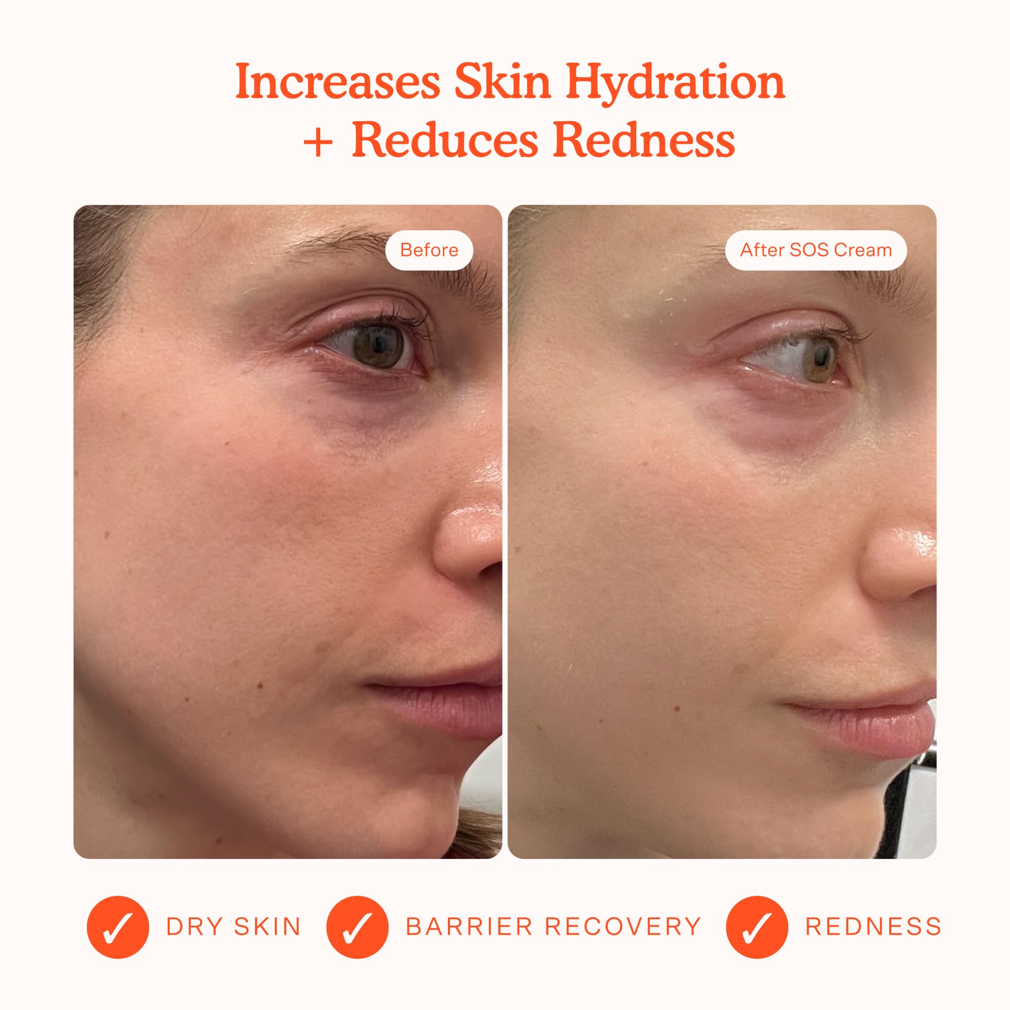 Tower 28 SOS Recovery Hydrating Face Cream for sensitive skin in a 1.86 oz jar, showing the moisturizer's smooth texture.