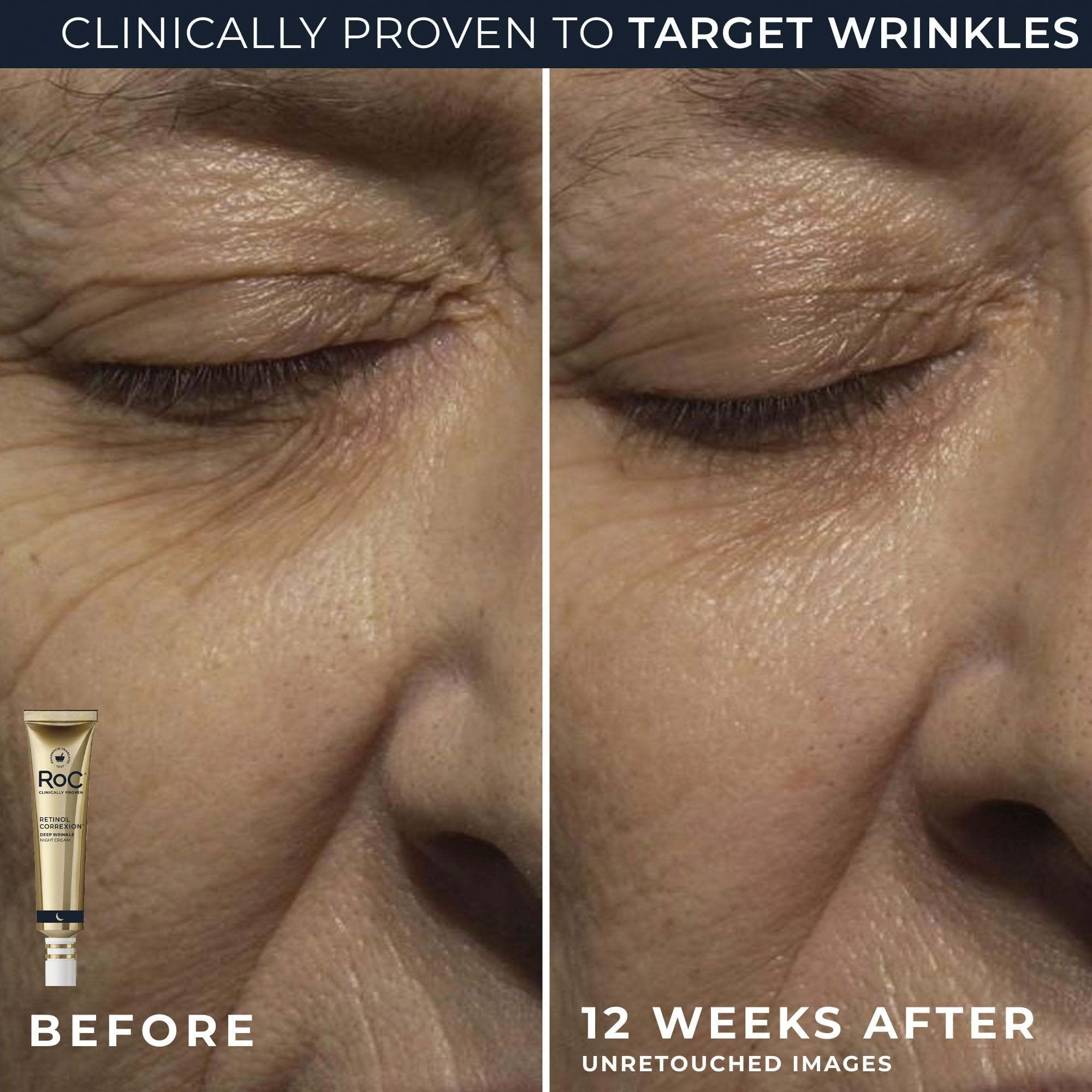 RoC Retinol Correxion deep wrinkle night cream and under eye cream set in jars, skincare moisturizer for anti-aging.