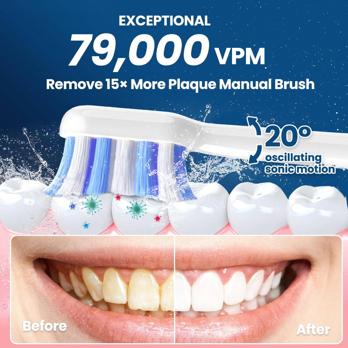 Electric Toothbrush with Pressure Sensor White - Marlincare Official Imagery - 4