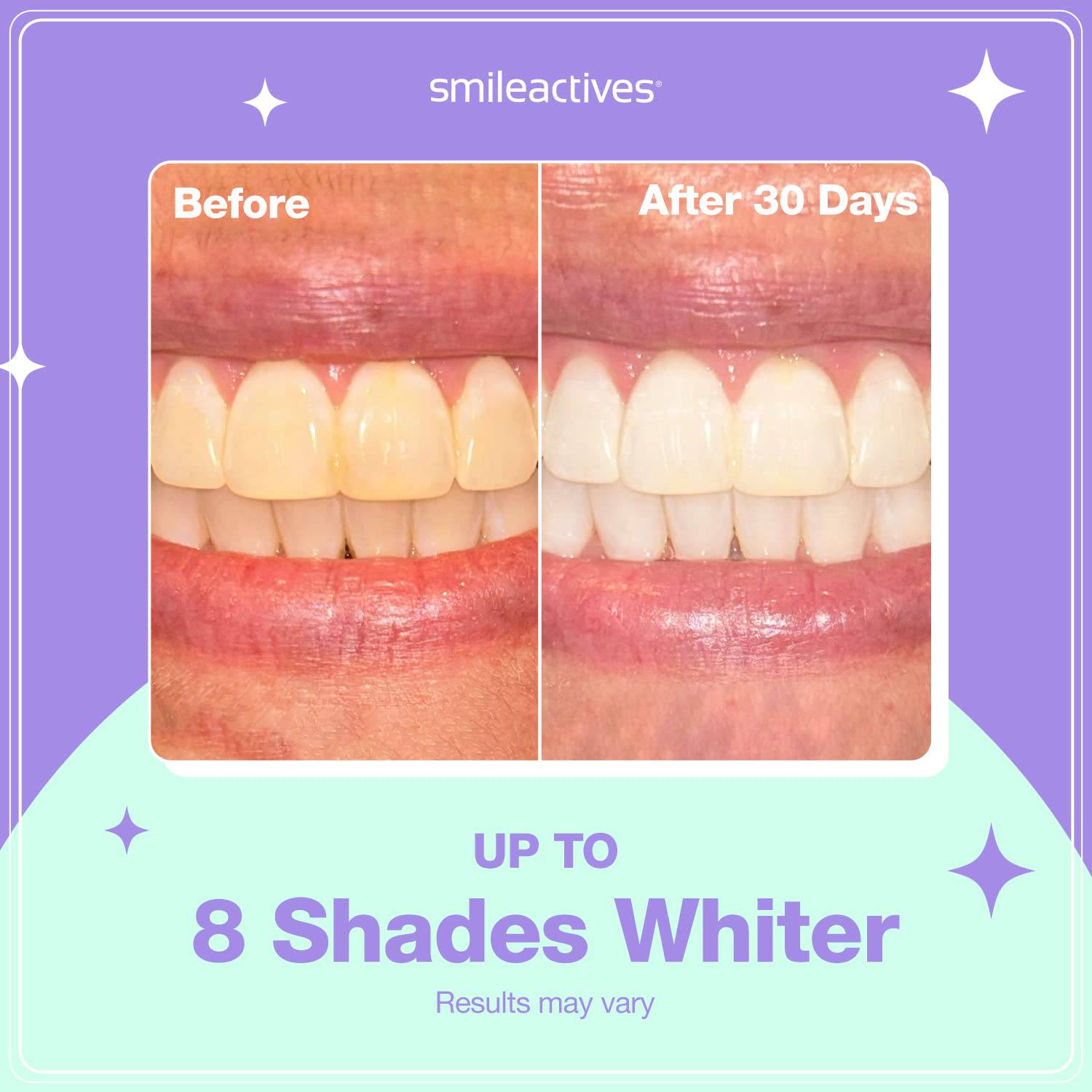Smileactives teeth whitening kit for 60-day treatment, showing whitening gel tubes and applicator brushes on a white background.
