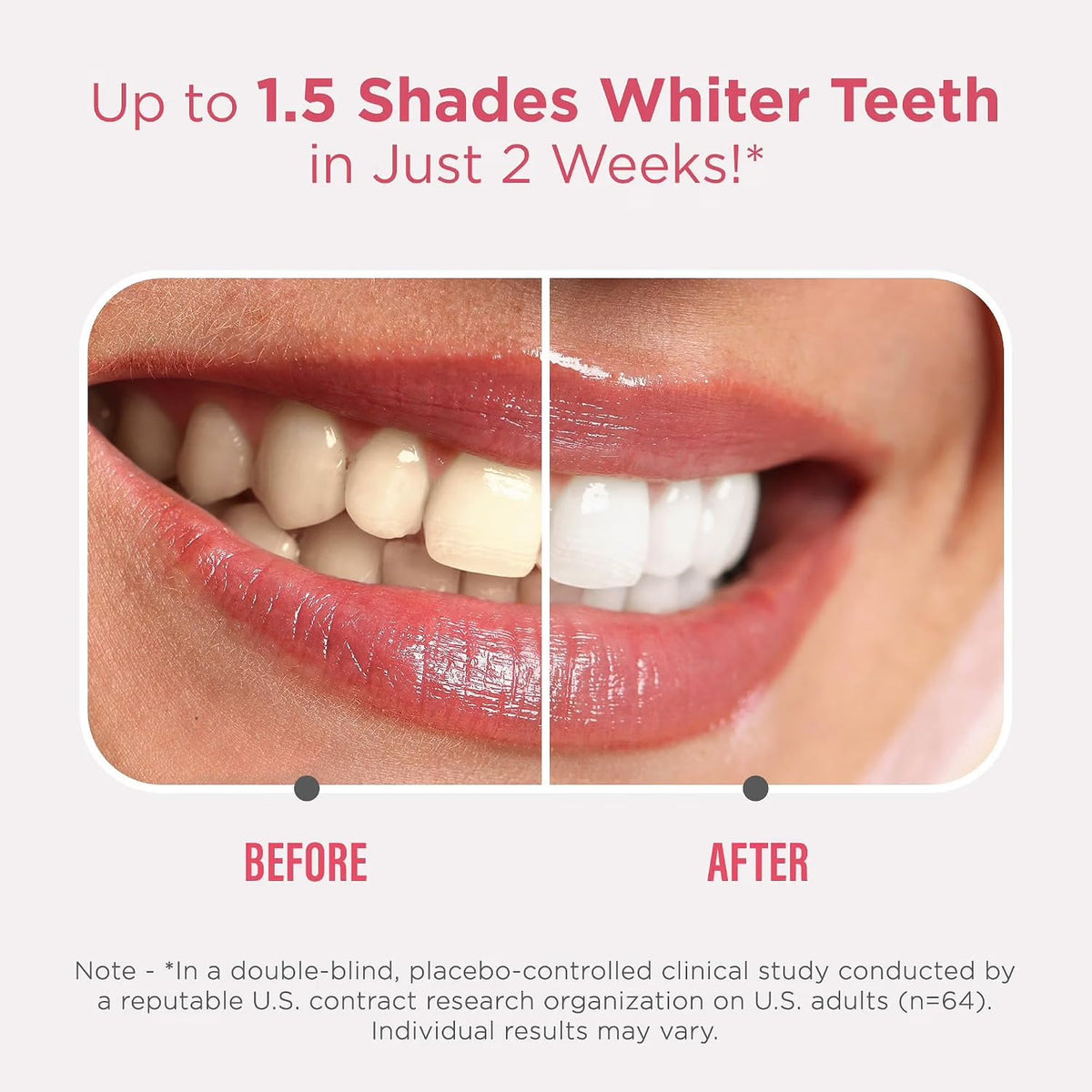 GuruNanda Oral Care Whitening Bundle Multi Action - GuruNanda Official Imagery - 5