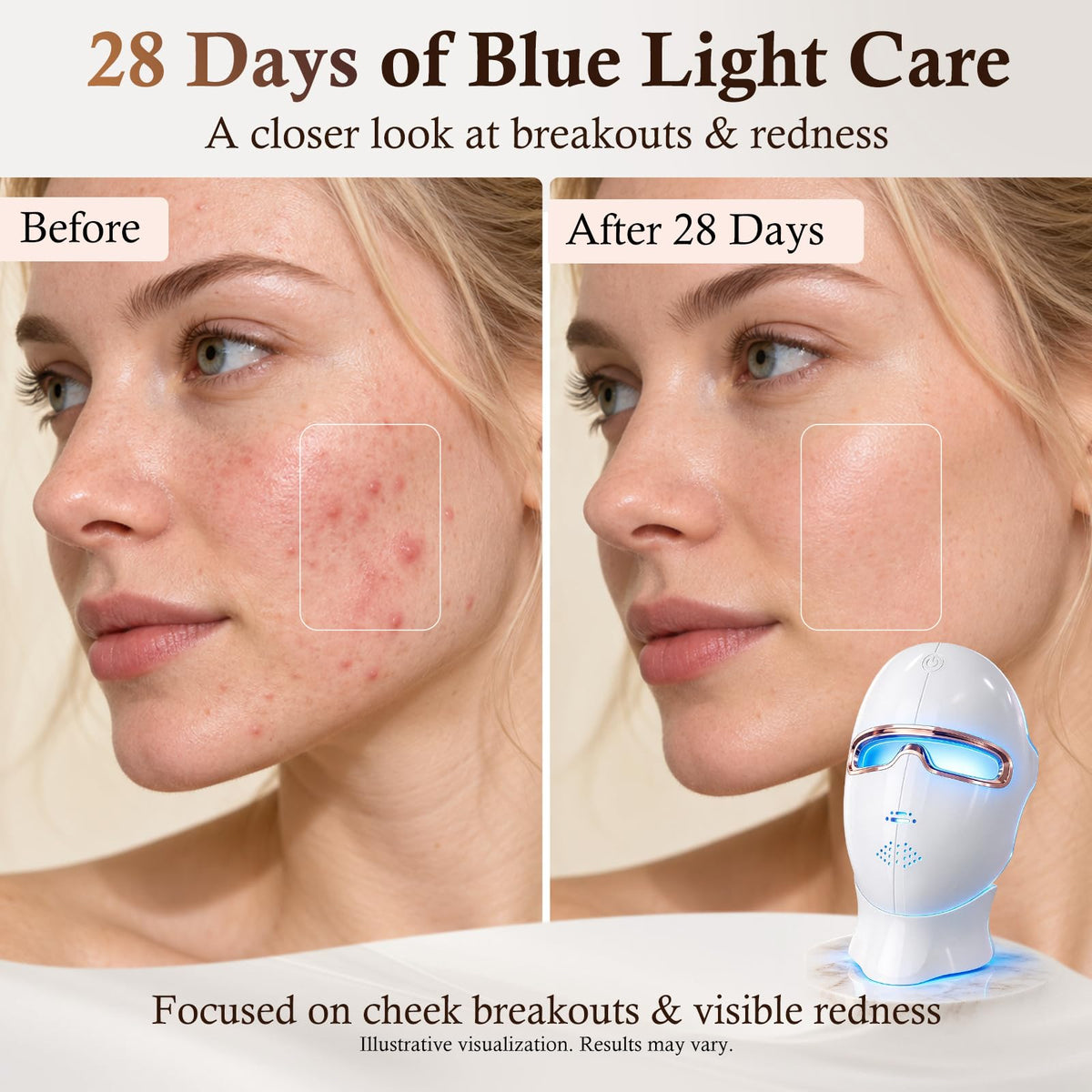 Red Light Therapy Mask for Face 850nm NIR Treats Acne - Aimilove Official Imagery - 8