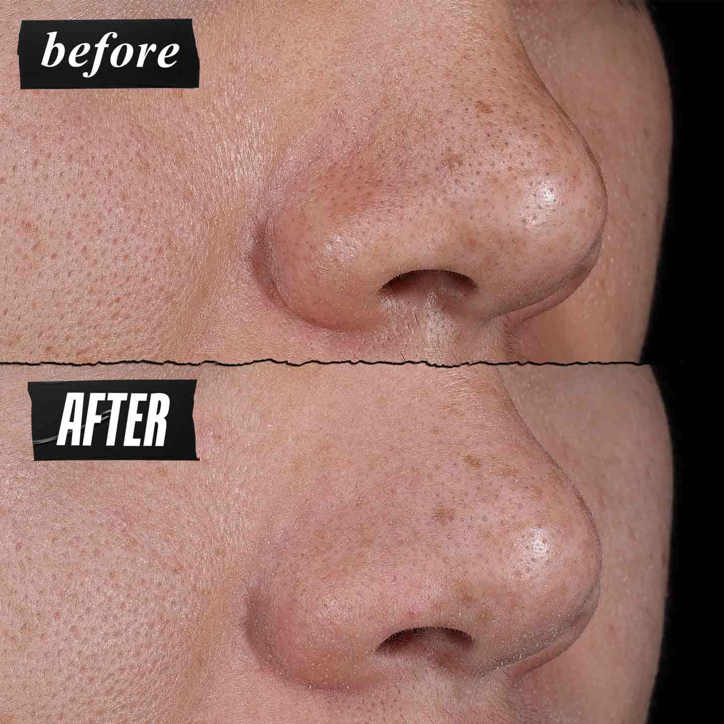 Kiehl's Rare Earth Clay Face Mask for minimizing pores, applied on clean skin in a skincare treatment setting