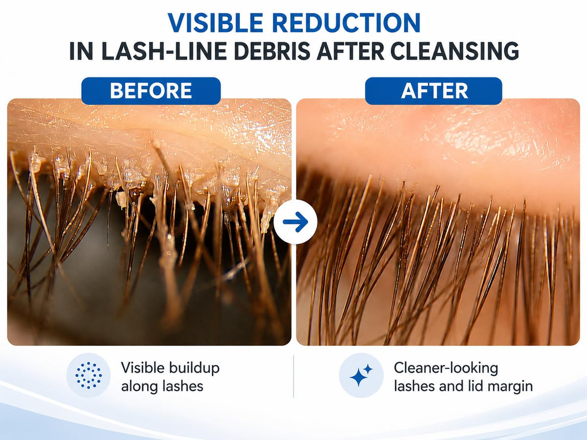 Myboclean Mybo Clean Eyelid Cleansing Brush for Sensitive Skin (1 Pc) + Hydrating Lids and Lash Cleansing Gel (1Pc) + Tr