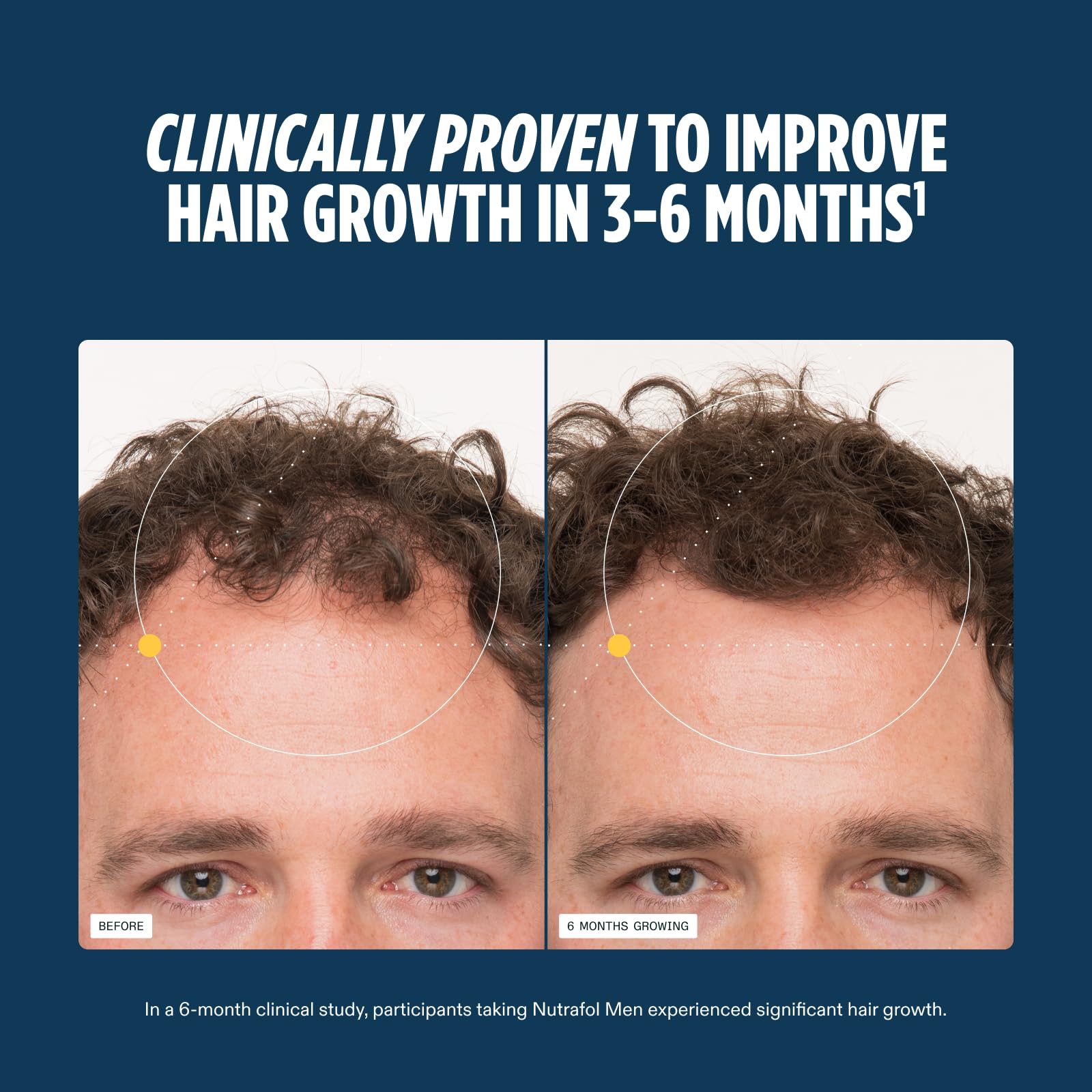 Nutrafol Men Hair Growth Supplements topically shown with bottles, promoting hair regrowth for ages 18-49 in a 2-month bundle.