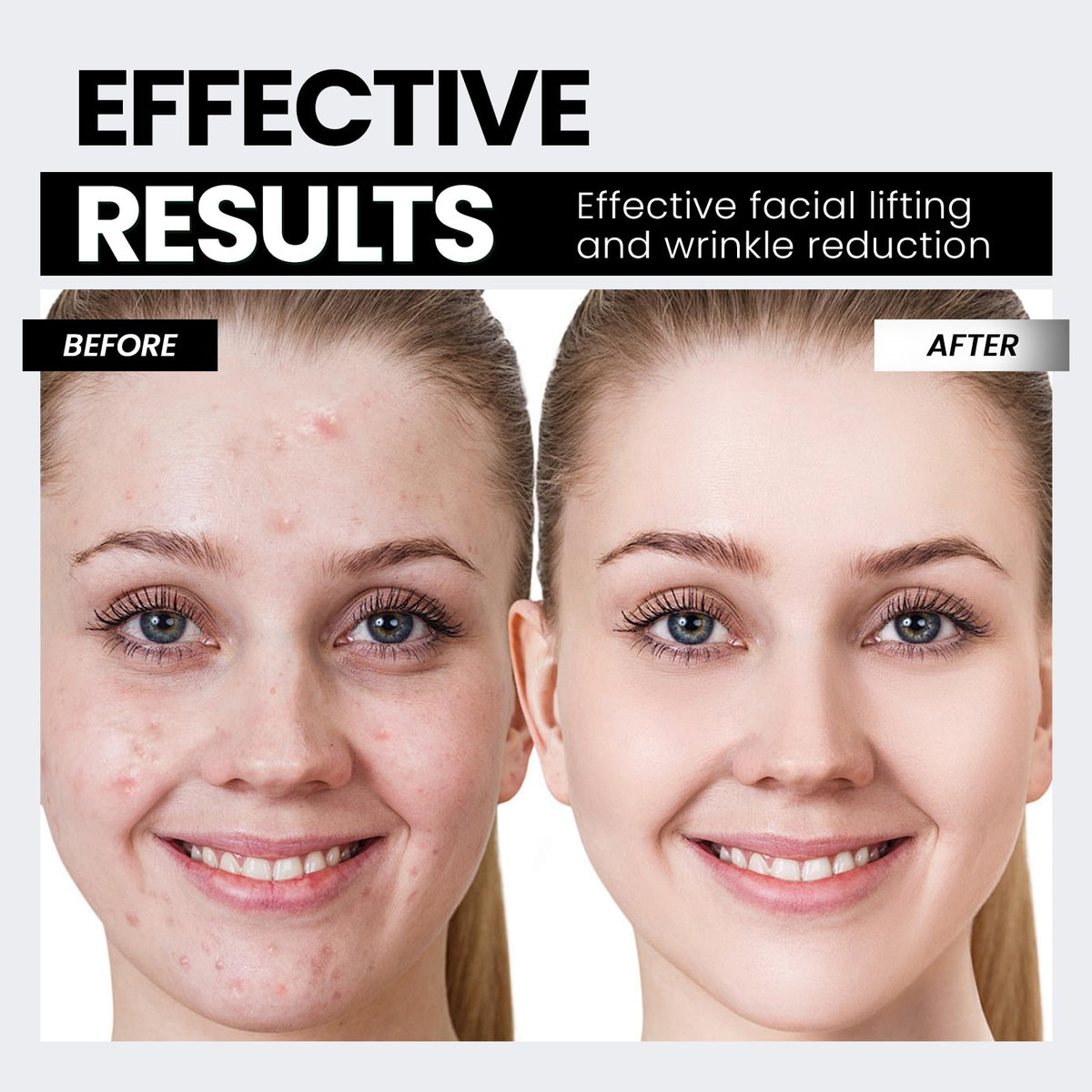Microcurrent Facial Device Latest Red Light Technology - Hunvva Official Imagery - 5