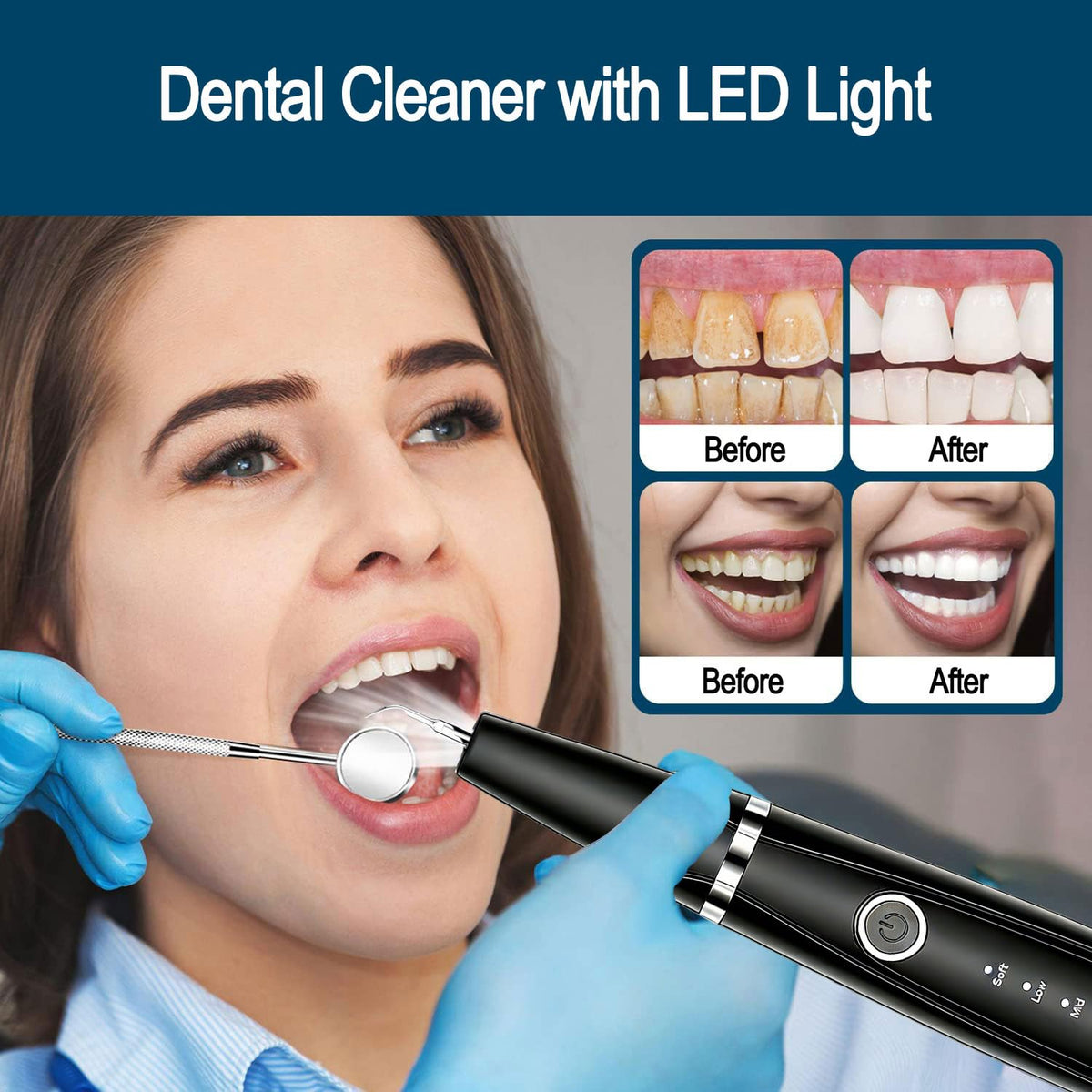 Sonic Dental Cleaner with LED Light 5 Modes Teeth Cleaning - Ujhosld Official Imagery - 7