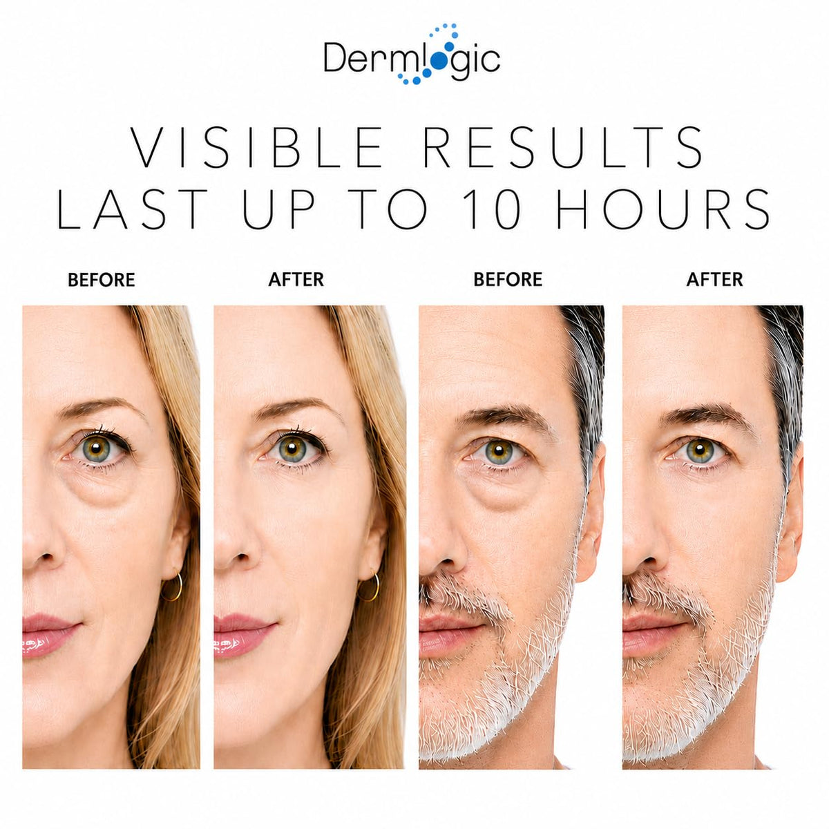 Dermlogic Under Eye Puffiness & Dark Circles Rapid Treatment- Instantly Reduces the Appearance of Puffy Eye Bags, Crow’s