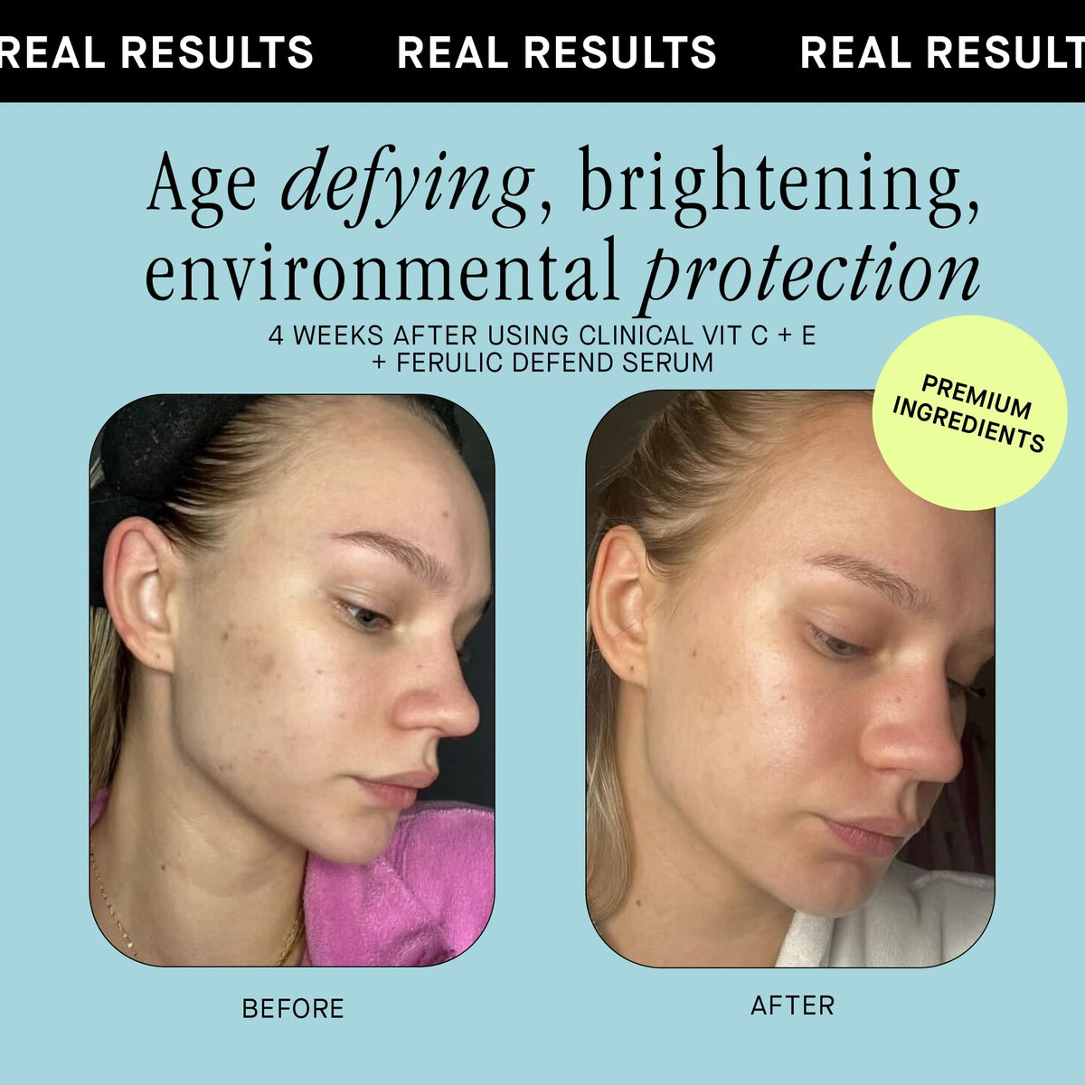 Brandefy Vitamin C Face Serum 15 L Ascorbic Acid Ferulic - Brandefy Official Imagery - 7