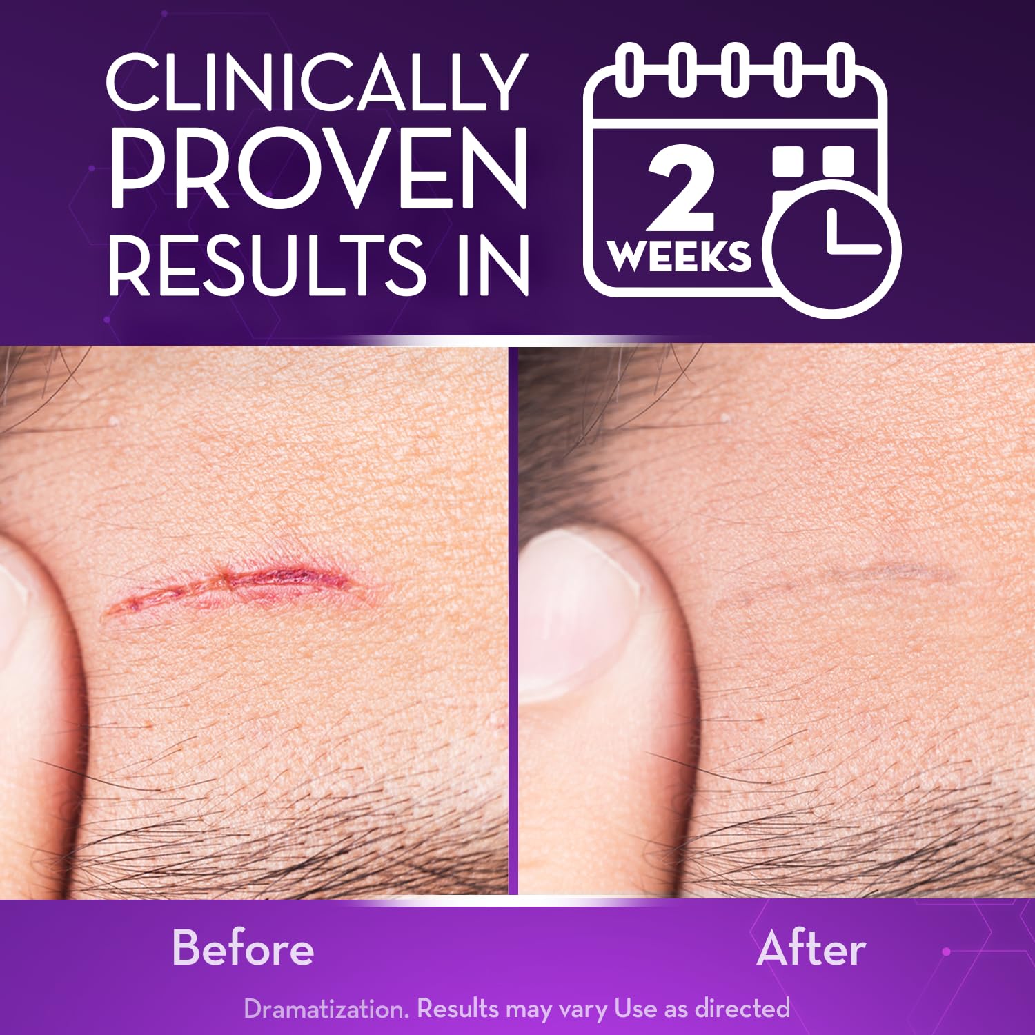 Cicatricure Advanced Scar Gel | 2 oz – Clinically Proven