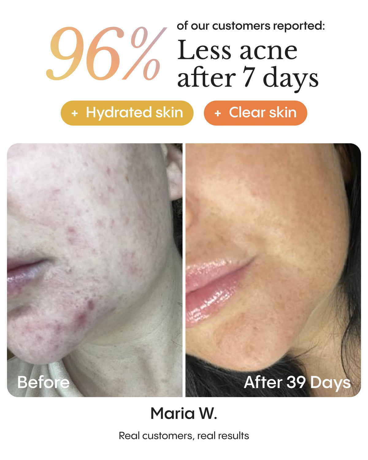 Organics Instant Blemish Redness Stopper Balm for Face - Premium Selection Official Imagery - 7