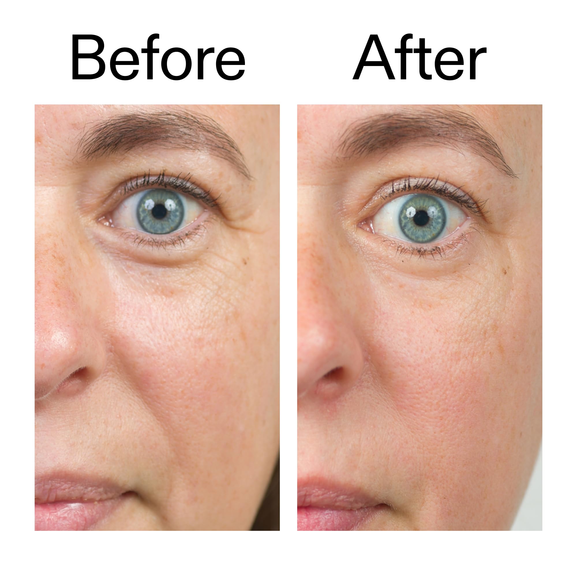 The INKEY List Bio-Active Ceramide Moisturizer 50ml, a skincare moisturizer with ceramides in a clear jar with a white lid.