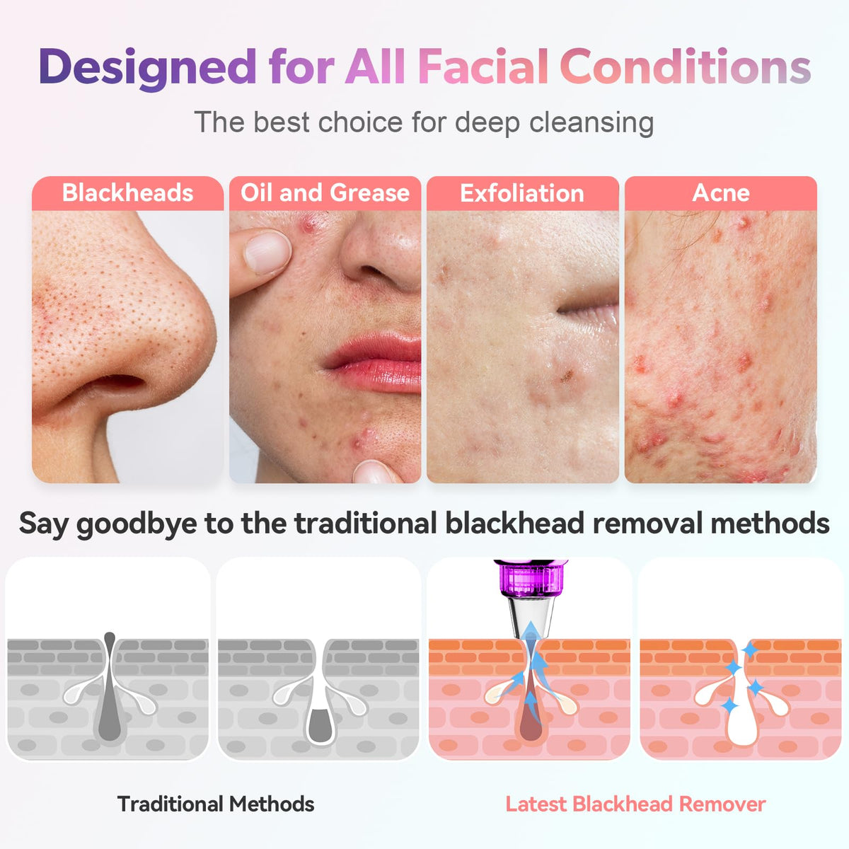 Blackhead Remover Vacuum Facial Pore Extractor 5 Suction - FREESHOW Official Imagery - 4