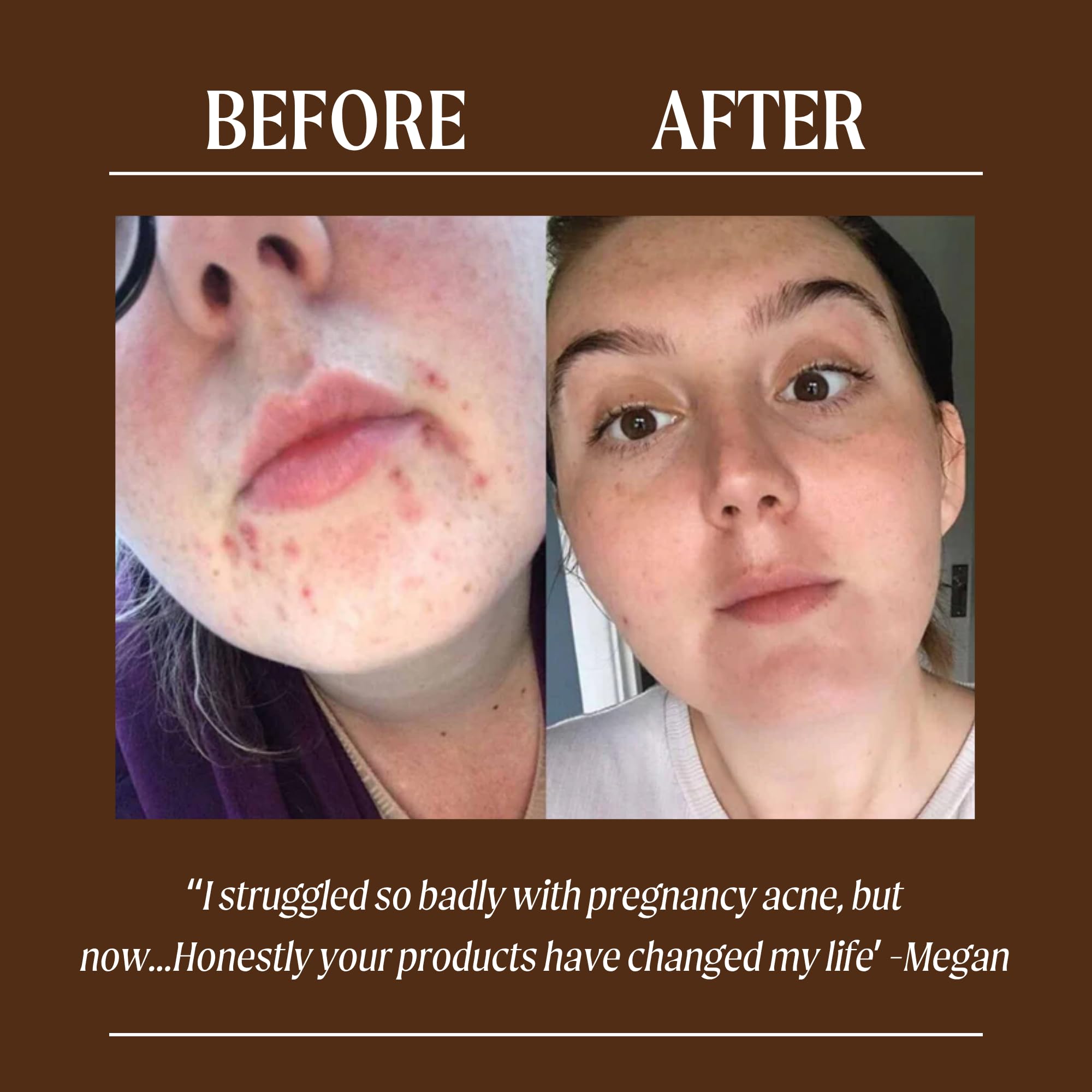 UPCIRCLE Face Moisturizer with Argan Powder 1.7oz - Nourishing Day Cream - Vitamin E, Aloe Vera, Glycerin, Shea + Coconut Butter - Natural, Vegan + Cruelty-Free