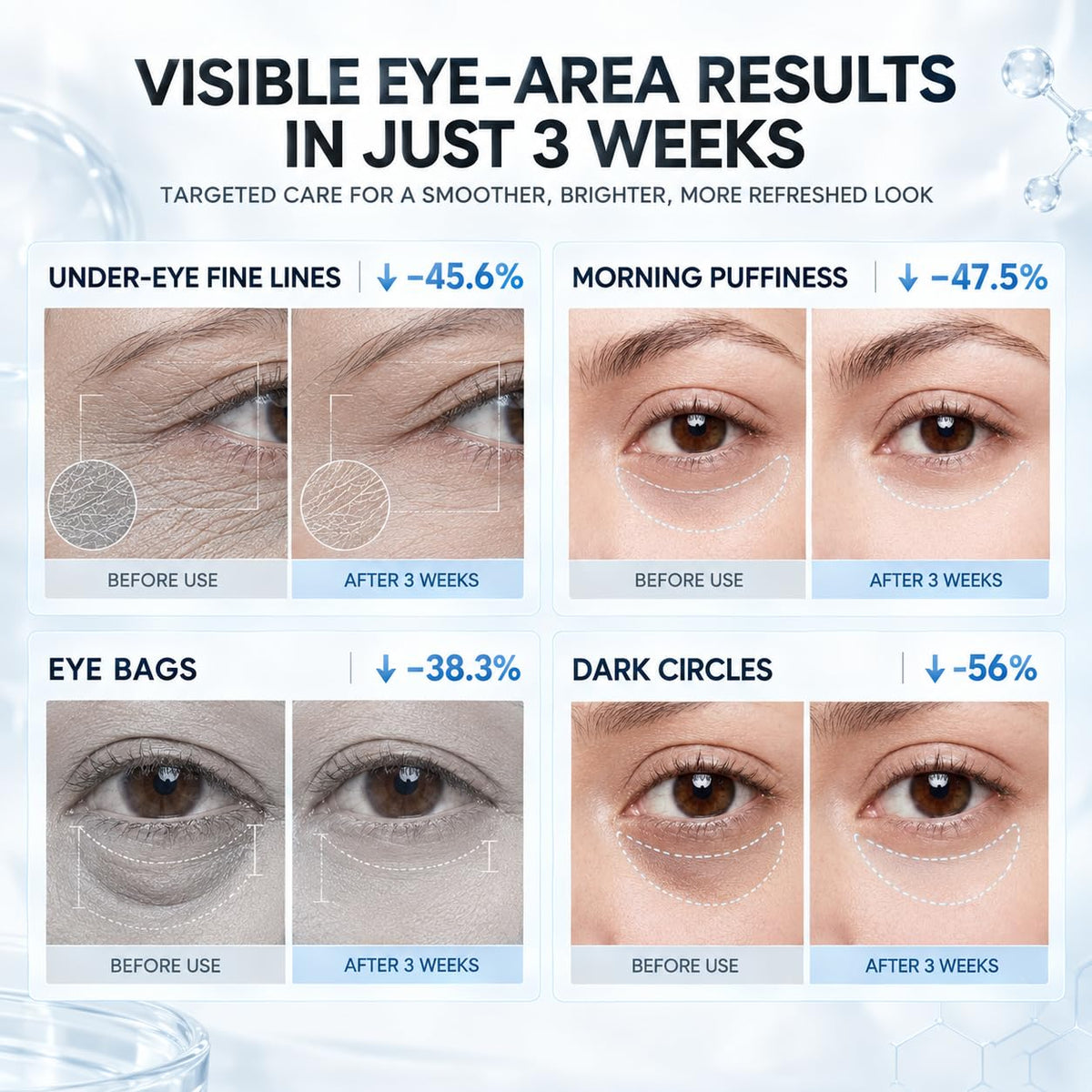SKINTIFIC Lifting Eye Cream, Reduce Puffiness/Fine Lines/Dark Circle 0.7 oz – close-up detail