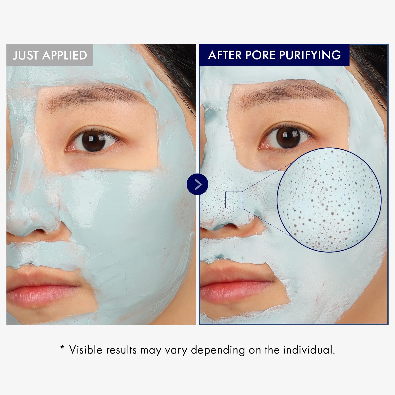 TOSOWOONG Real Blackhead Mud Mask for pore care, oil control, and cooling, shown on skin with a smooth, clay-like texture.