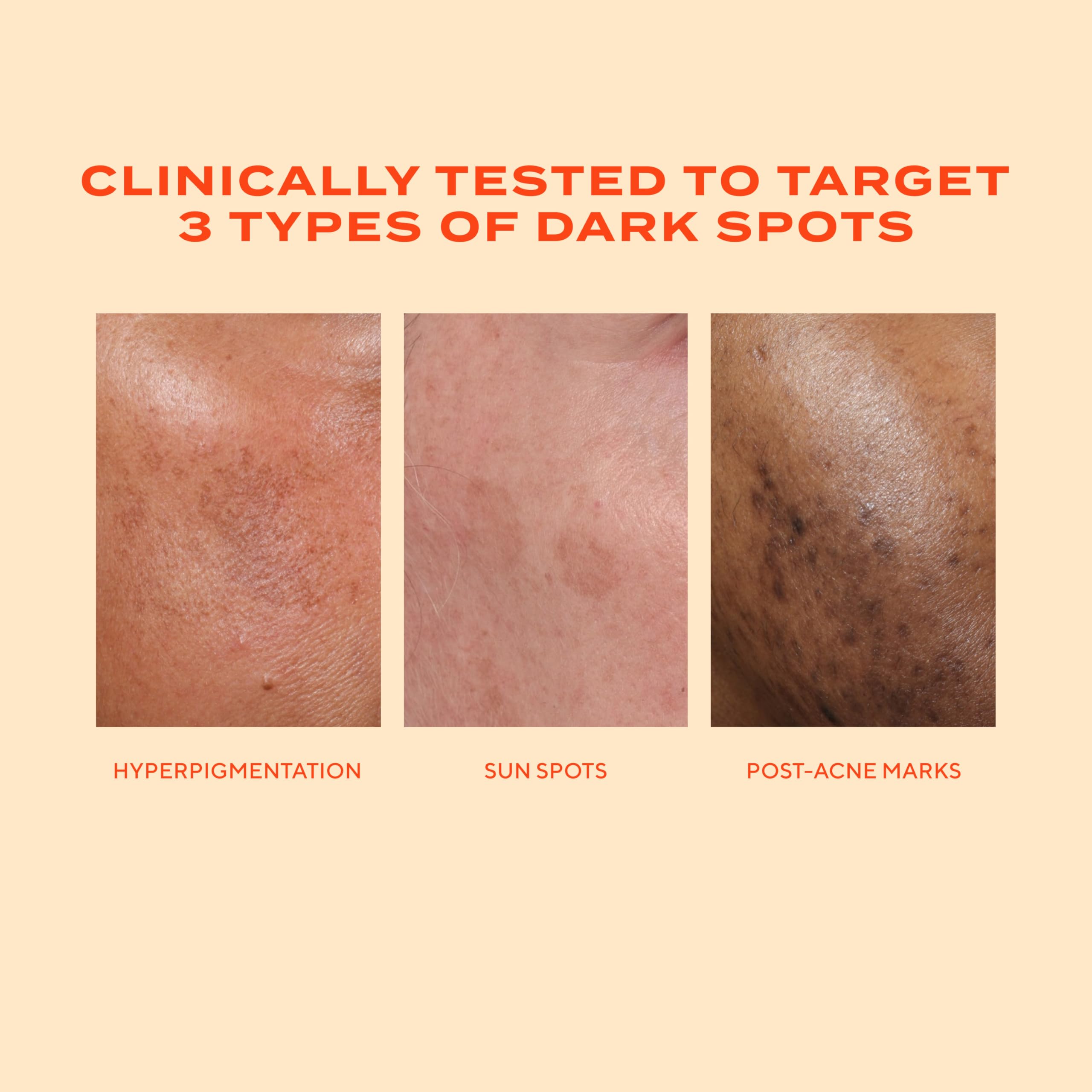Murad Rapid Dark Spot Correcting Serum with glycolic acid in a 1 oz bottle, designed to improve skin tone and fade dark spots.