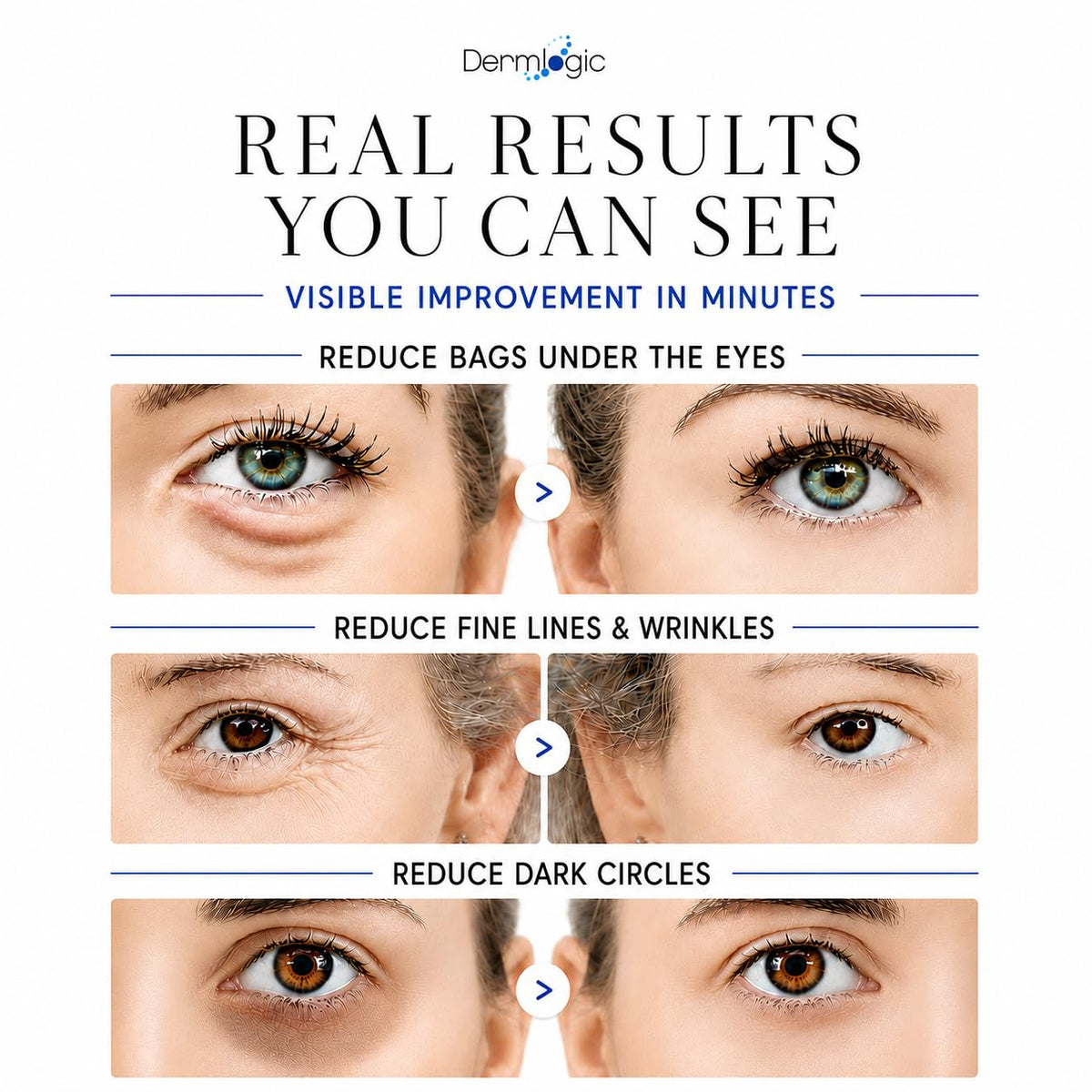 Dermlogic Under Eye Puffiness & Dark Circles Rapid Treatment- Instantly Reduces the Appearance of Puffy Eye Bags, Crow’s