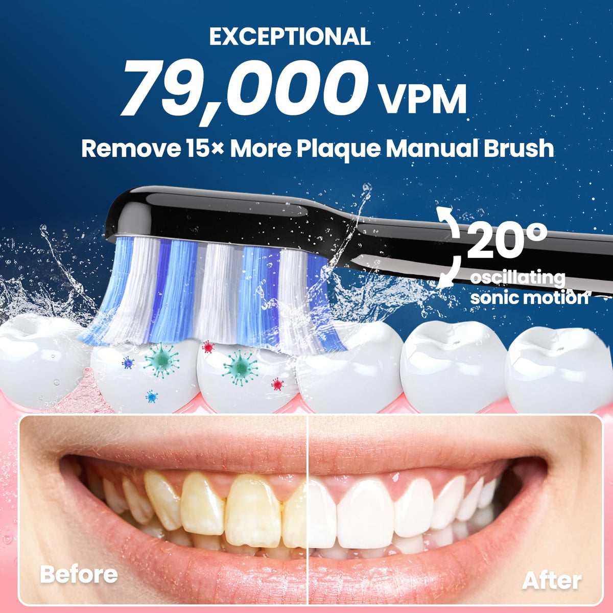 Electric Toothbrush with Pressure Sensor Black - Marlincare Official Imagery - 4