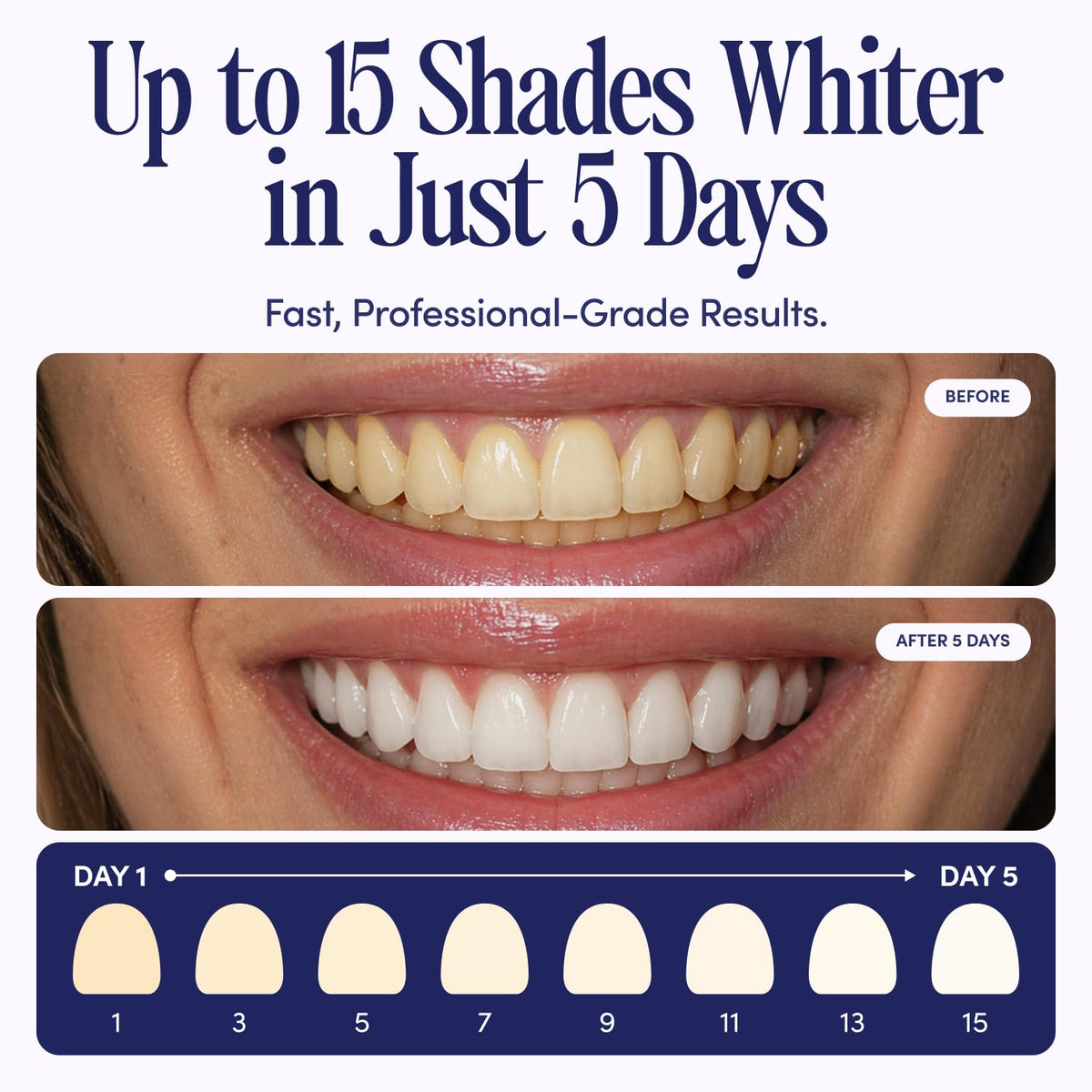 Teeth Whitening U Wraps - Boca Bella Official Imagery - 5