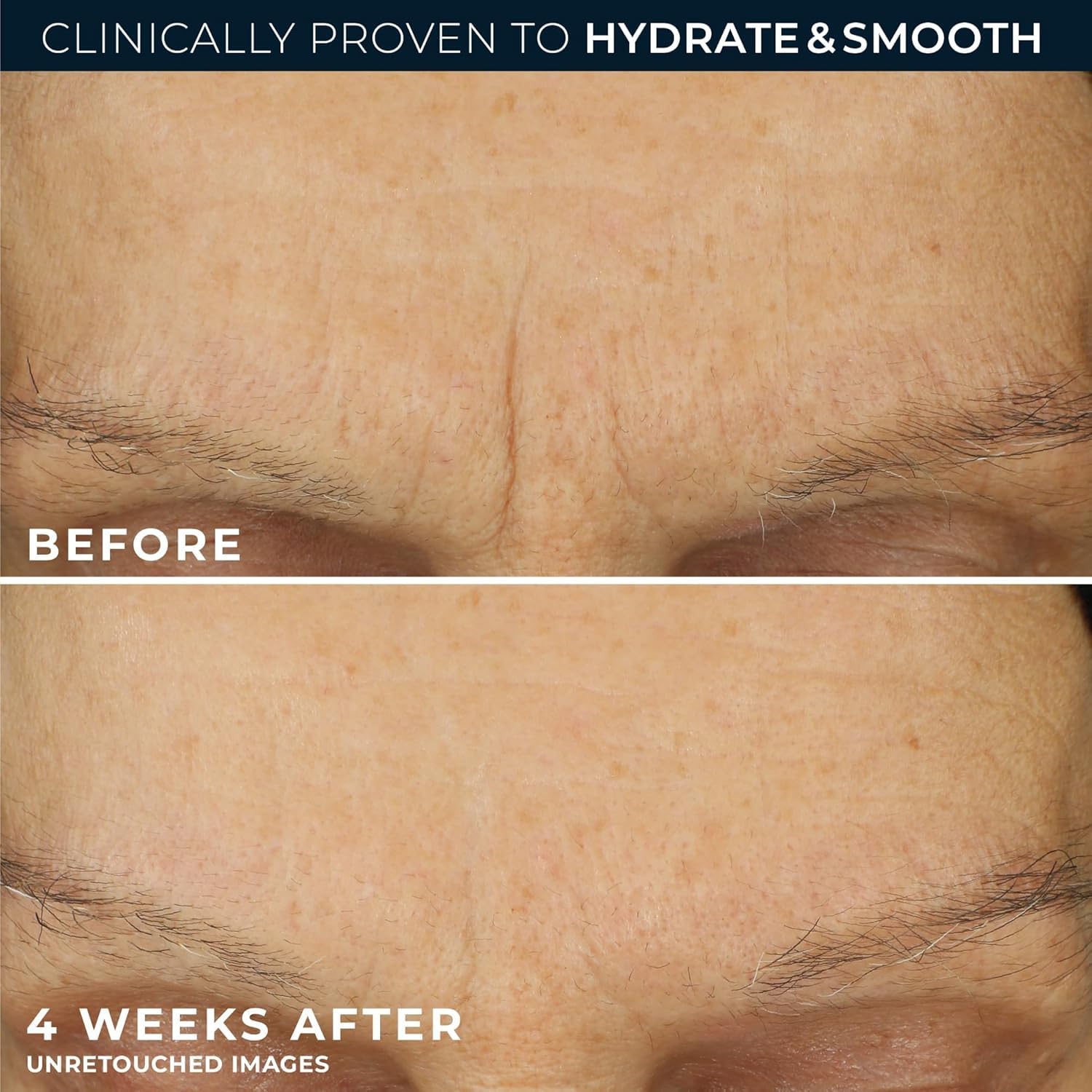 RoC Retinol Correxion Max Hydration Cream in 1.7 oz jar, a skin moisturizer with retinol for deep hydration and skincare.