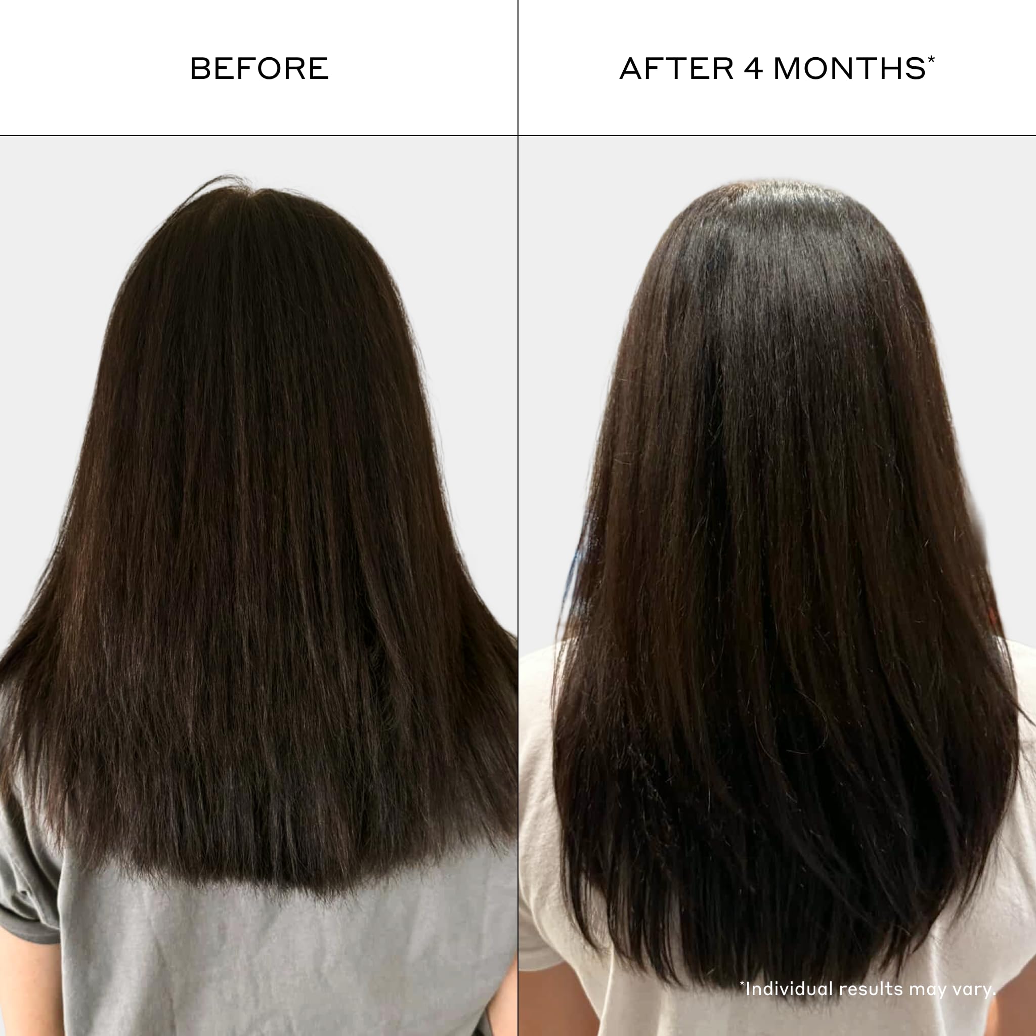 Zenagen Revolve unisex conditioner bottle, 6.75 fl oz, for topical hair regrowth treatment with 1-minute formula.