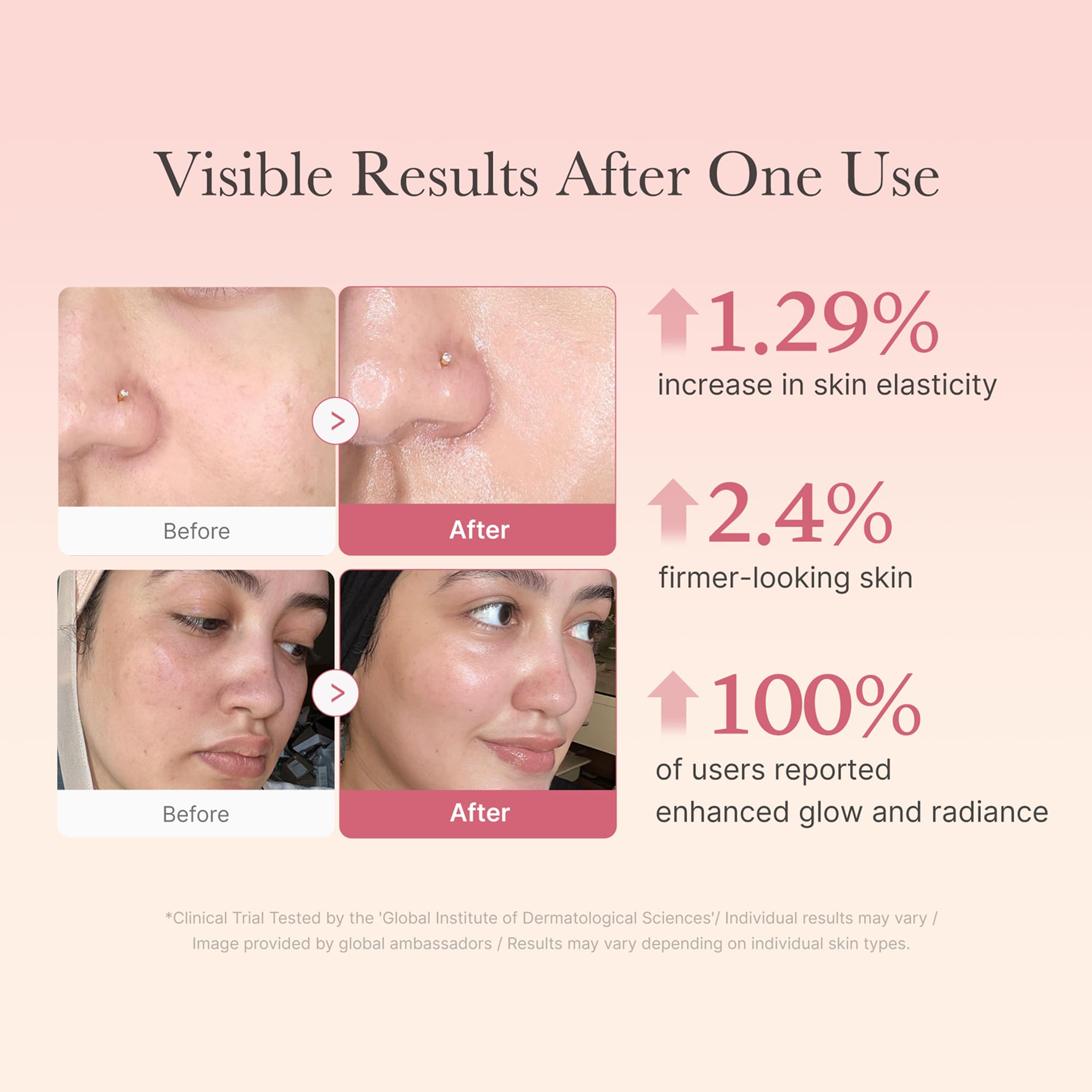 Medicube Collagen Niacinamide Jelly Cream in 3.71oz jar, moisturizing skin with a brightening, gel-like texture.