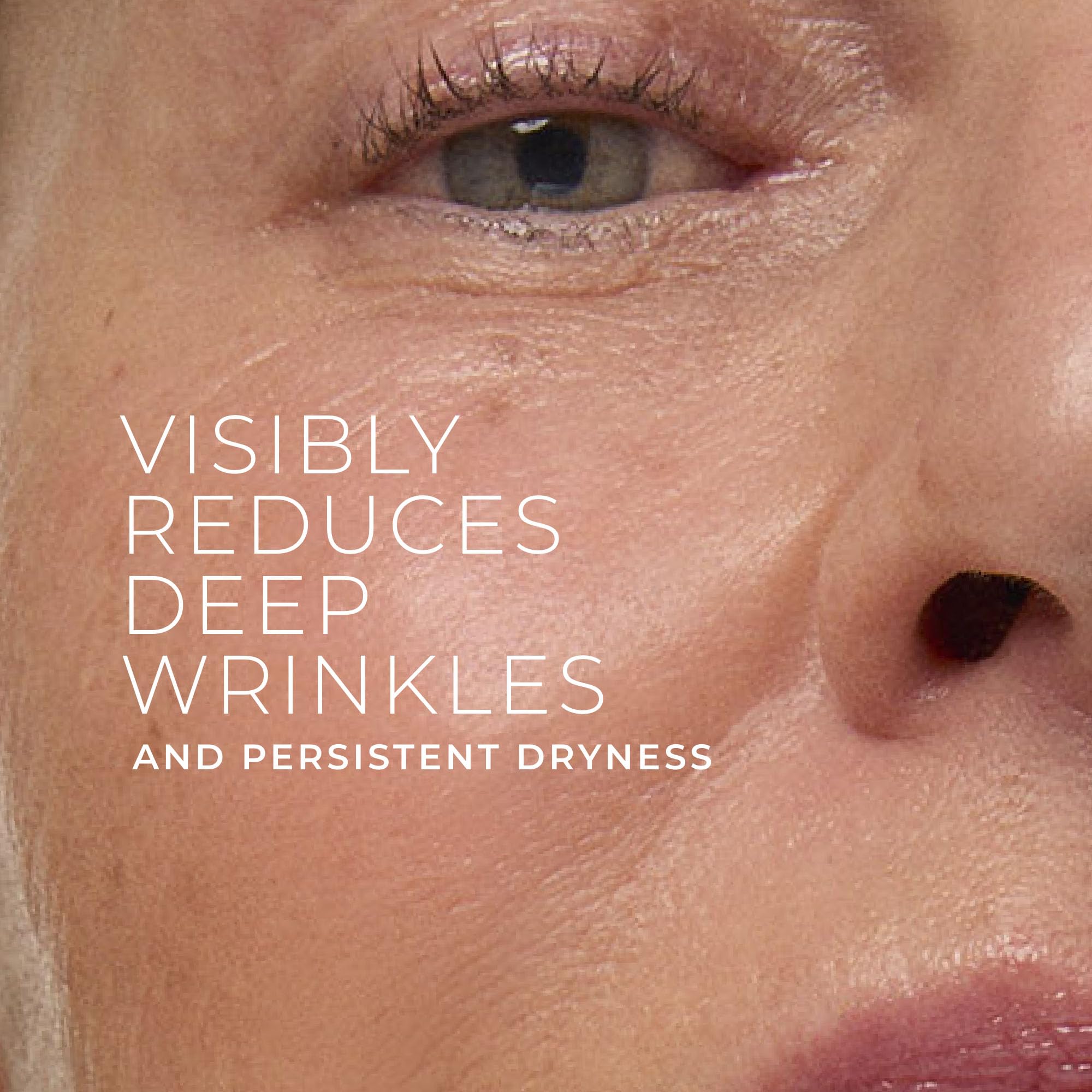 RoC Deep Wrinkle Rich Cream, fragrance-free anti-aging moisturizer, showing the jar with product label and smooth cream inside