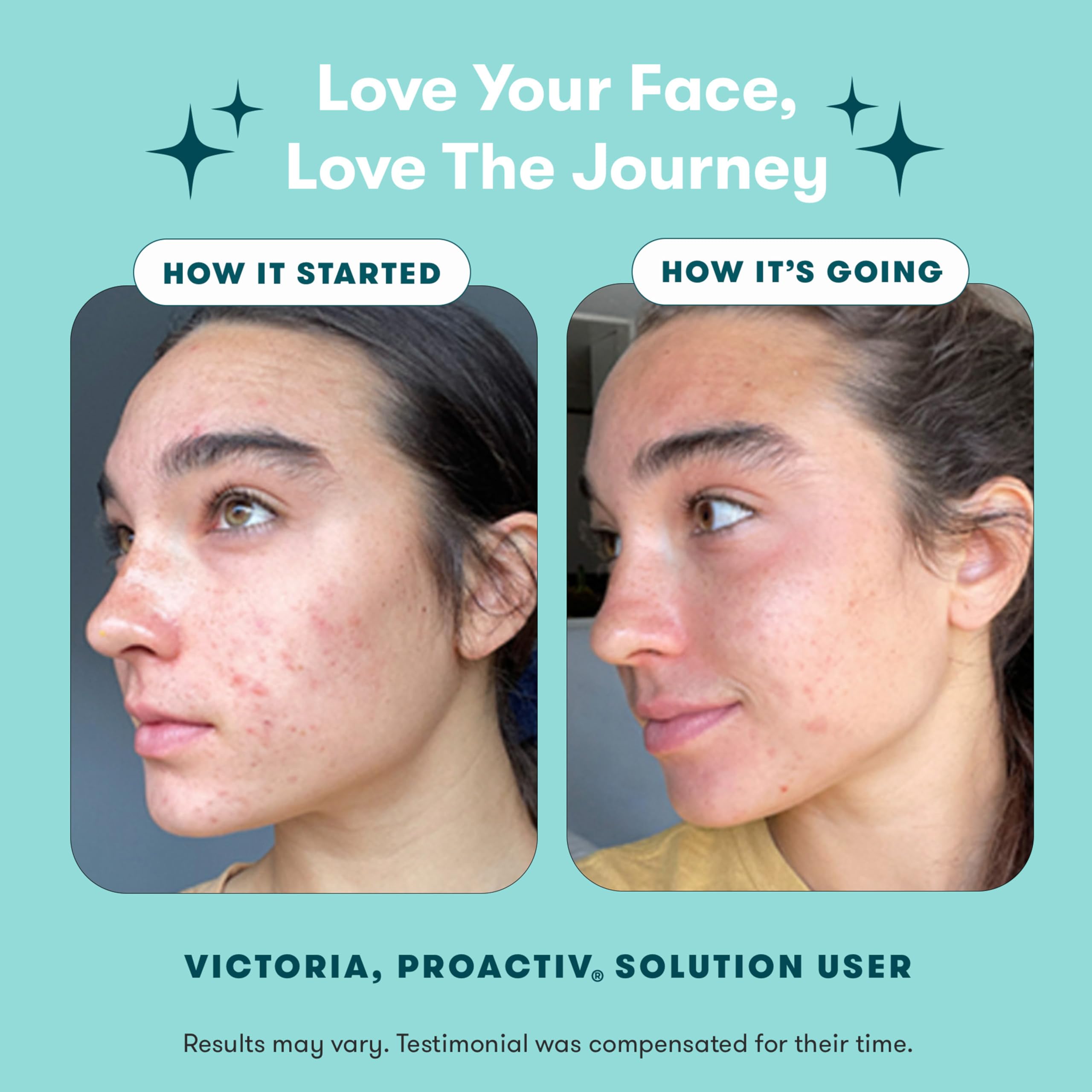 Proactiv 3-Step Acne Treatment Kit for clear skin, featuring cleanser, toner, and treatment products in a 30-day starter set.