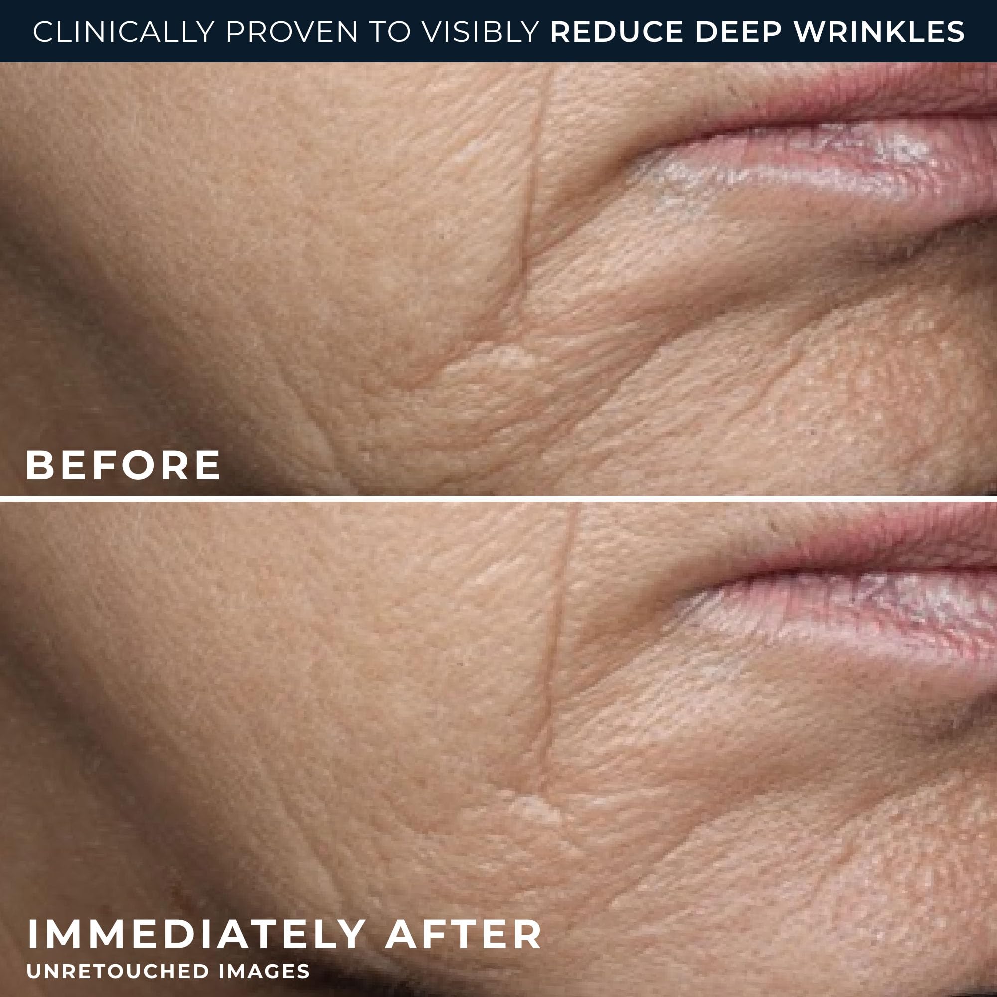 RoC Deep Wrinkle Rich Cream skincare moisturizer in a jar, fragrance-free anti-aging firming cream for daily skin hydration.