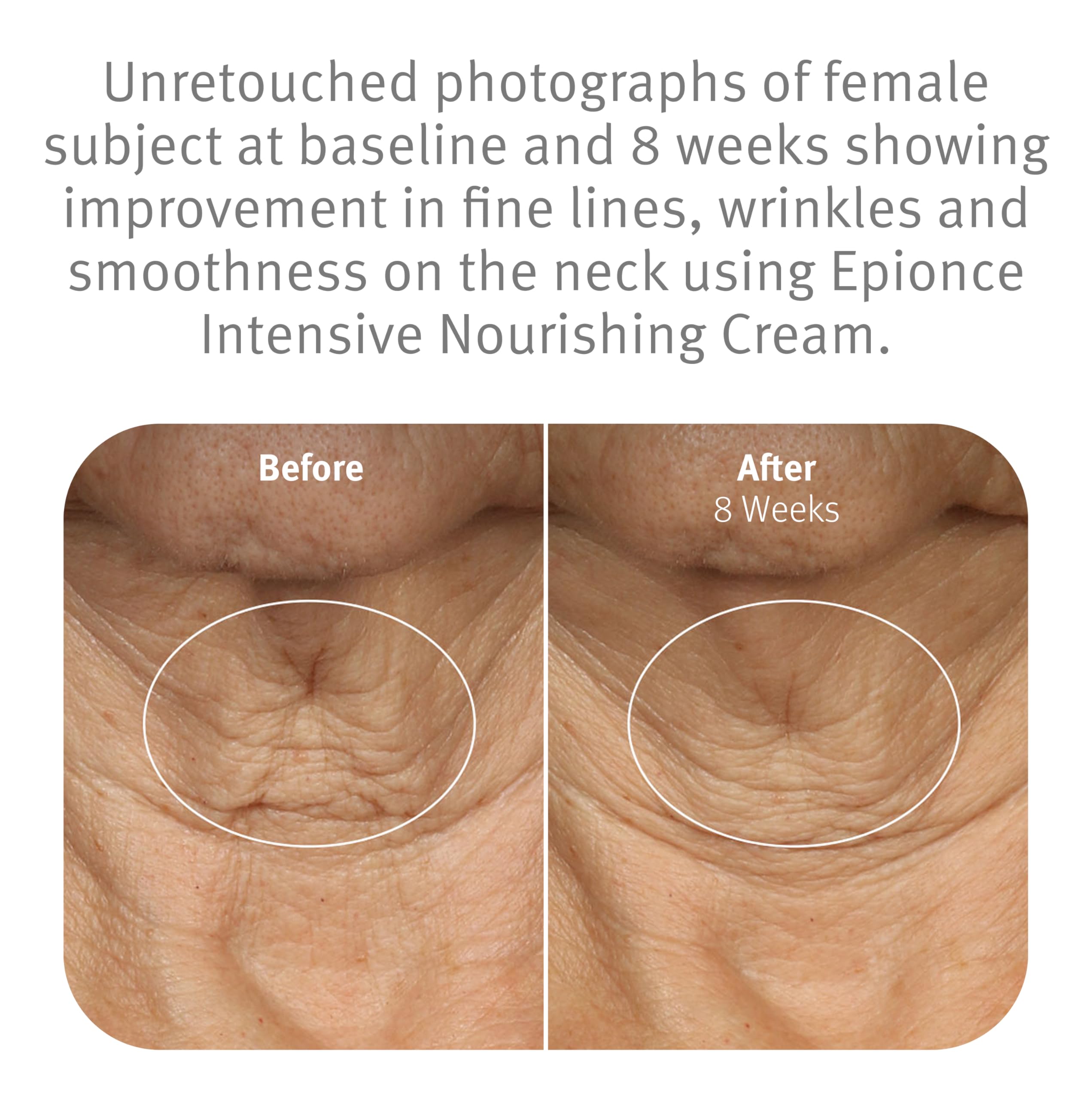 Epionce Intensive Nourishing Cream skin moisturizer for anti-aging, face, and neck with wrinkle-reducing formula.