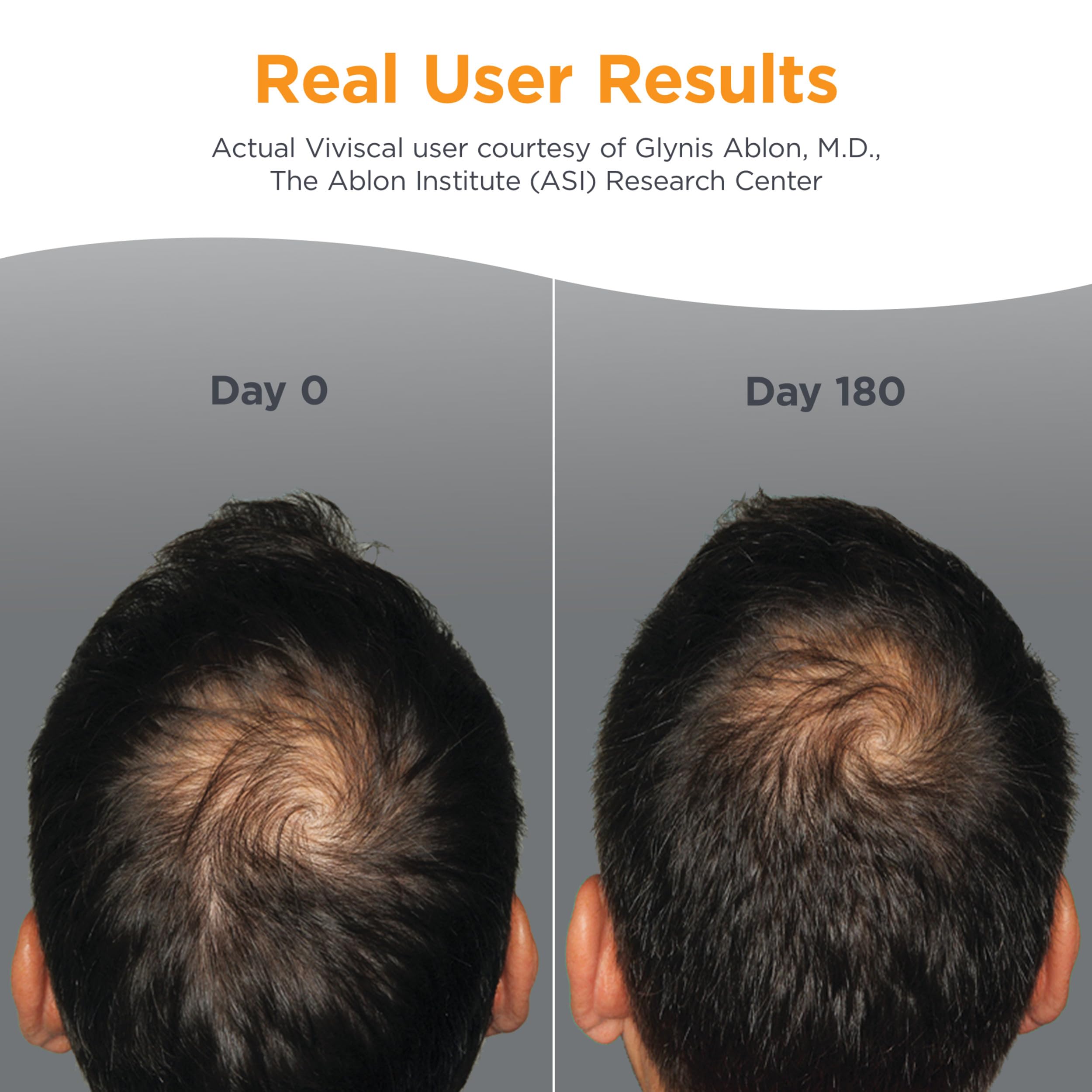 Viviscal Men's Hair Growth Supplements, 180 Tablets 3 Month Supply