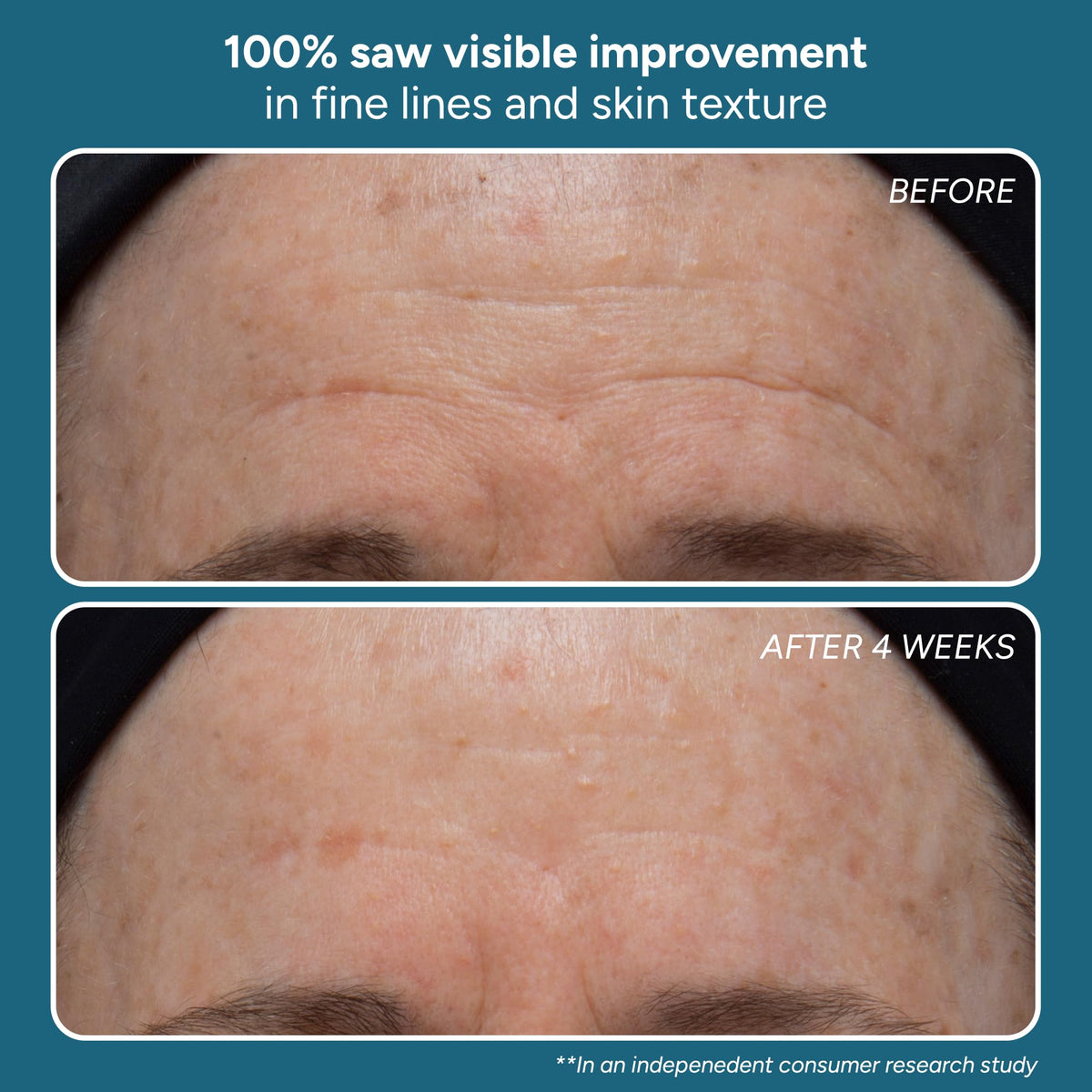 Lancer Skincare Intro Kit for Normal or Combination Skin - Lancer Official Imagery - 4