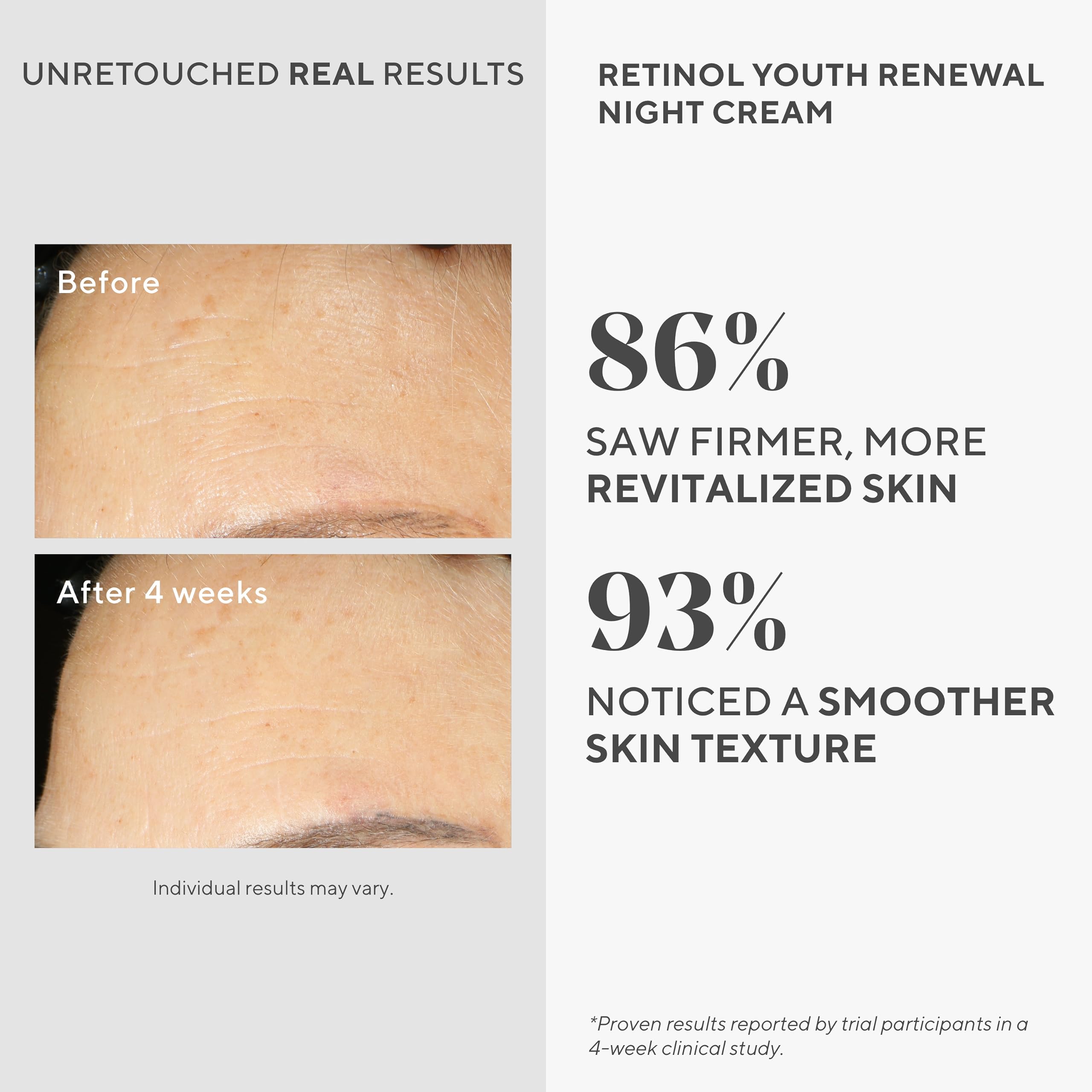 Murad Retinol Youth Renewal Night Cream 1.7oz jar showing the moisturizing cream in a sleek container for anti-aging skincare.