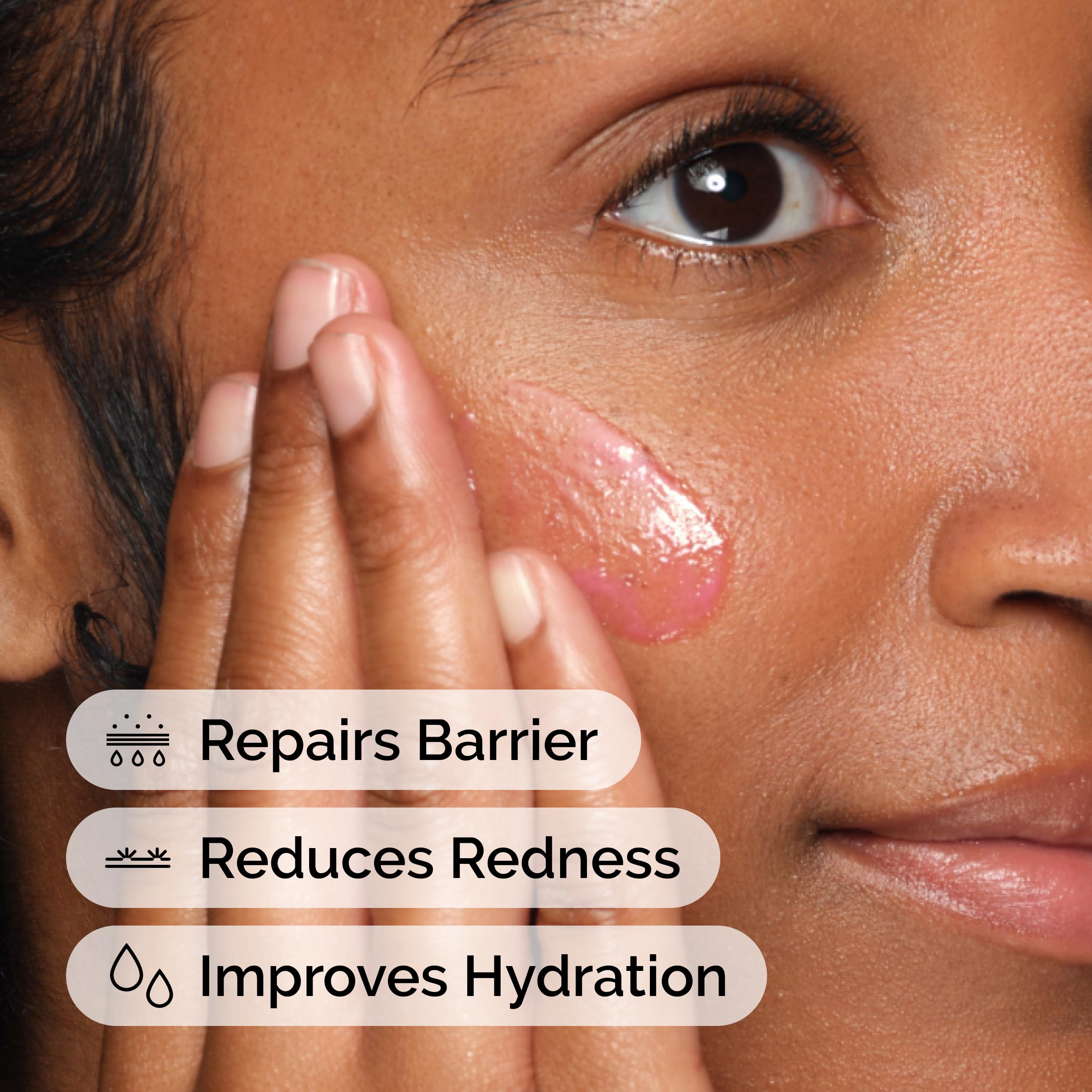 The Ordinary Soothing & Barrier Support Serum 1oz