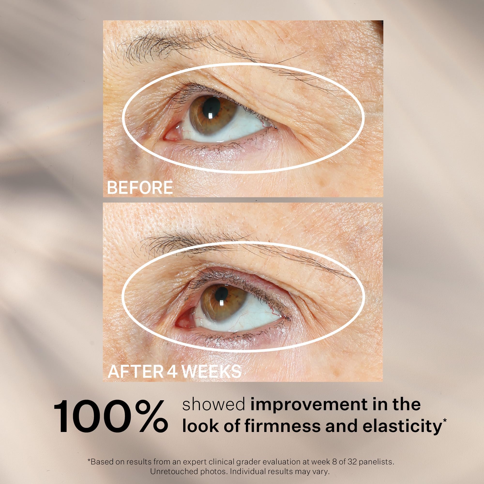 StriVectin Peptight® 360° tightening and brightening eye serum in a 1 oz bottle, shown with the serum applicator and packaging.