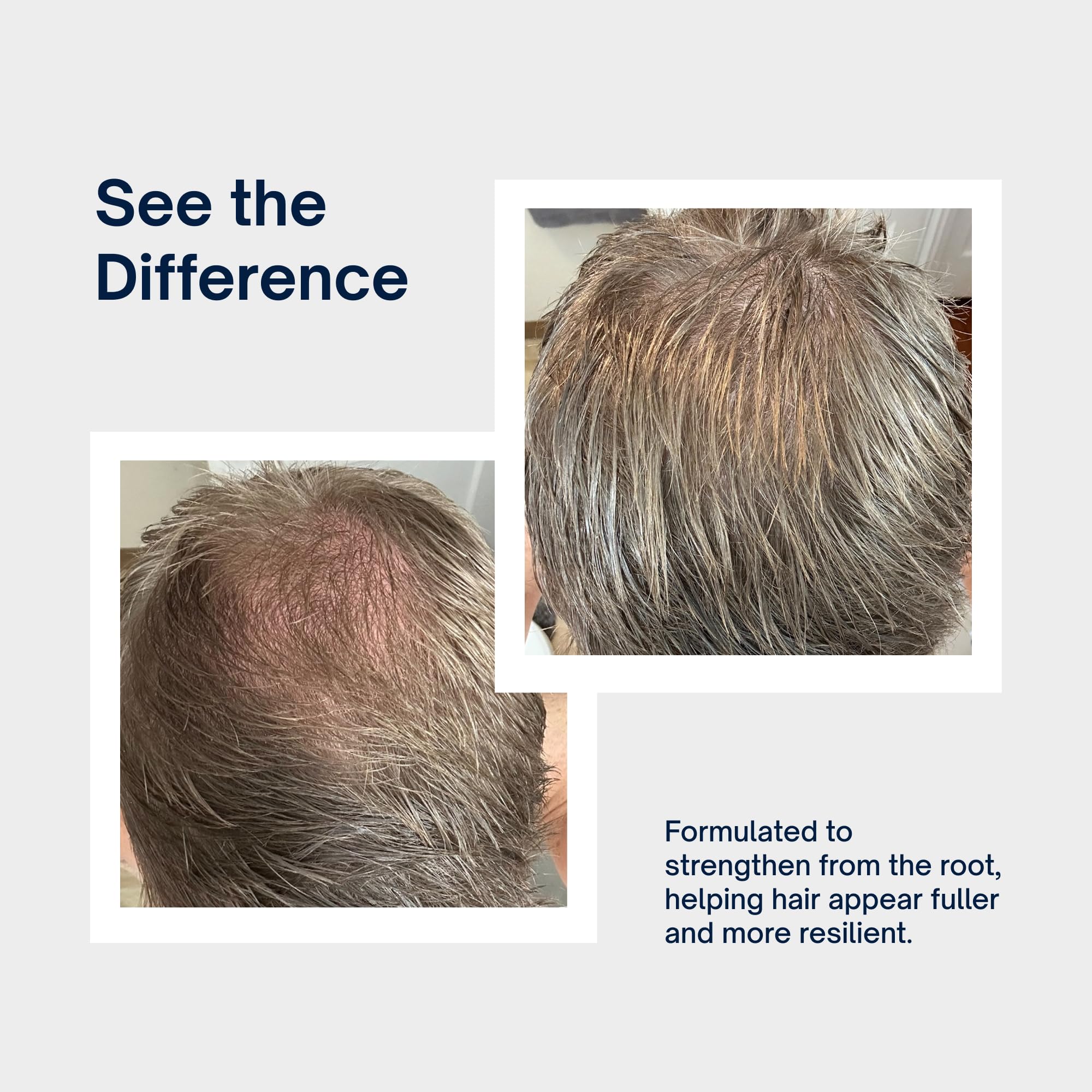 Intelligent Super Volumizing Hair Loss Shampoo in a 10 fl oz bottle, strengthens weakened hair and adds maximum volume.