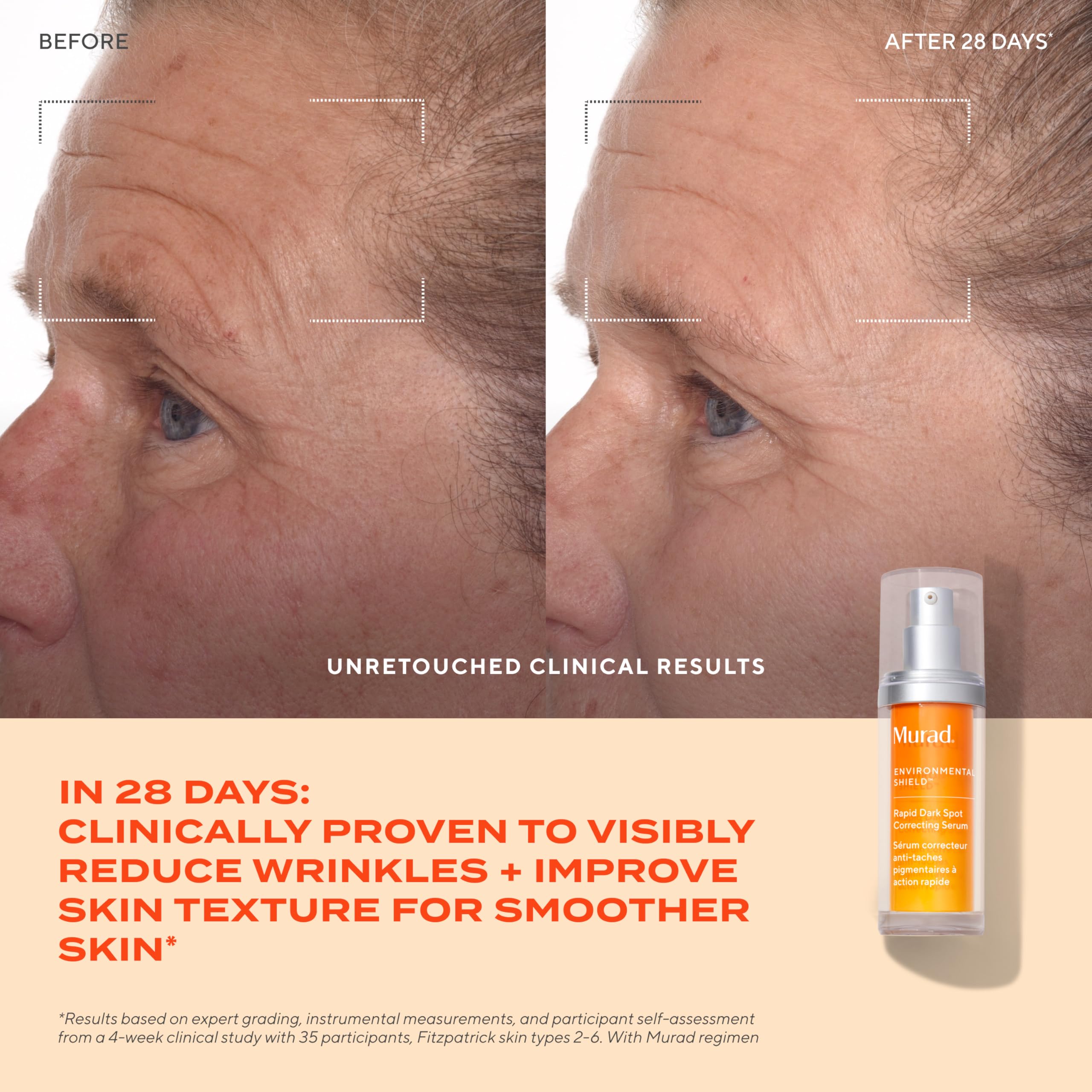 Murad Rapid Dark Spot Correcting Serum with glycolic acid, 1 fl oz, showing the serum bottle and applicator.