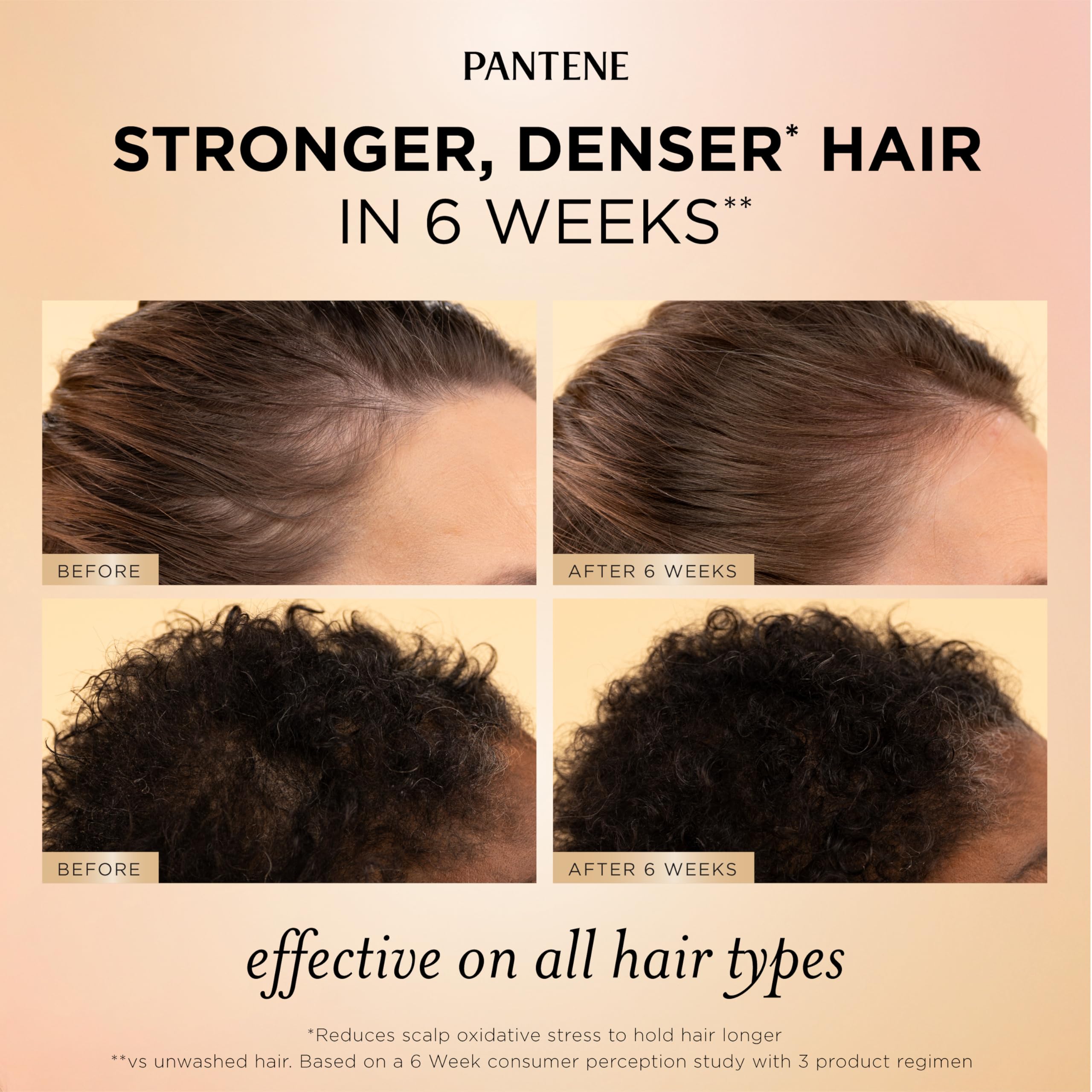 Pantene Abundant & Strong shampoo, conditioner, and serum for hair loss, thinning, and added volume.