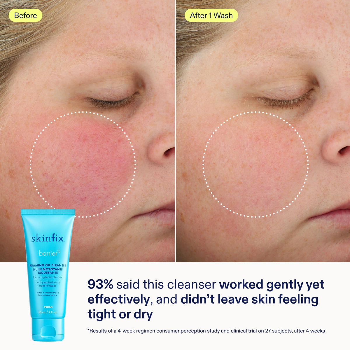 Skinfix Barrier Better Skin Starts Here Kit - Skinfix Official Imagery - 4