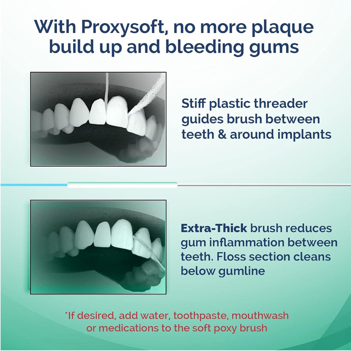 ProxySoft Periodontal Floss - Proxysoft Official Imagery - 4