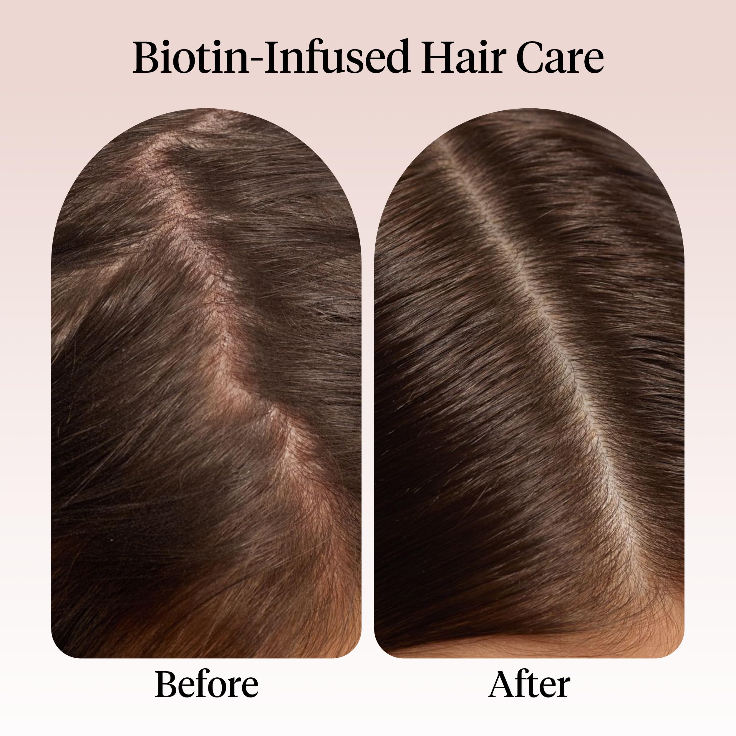 Kitsch Rosemary Hair Growth Oil bottle with castor oil, biotin, and jojoba for topical hair regrowth treatment.