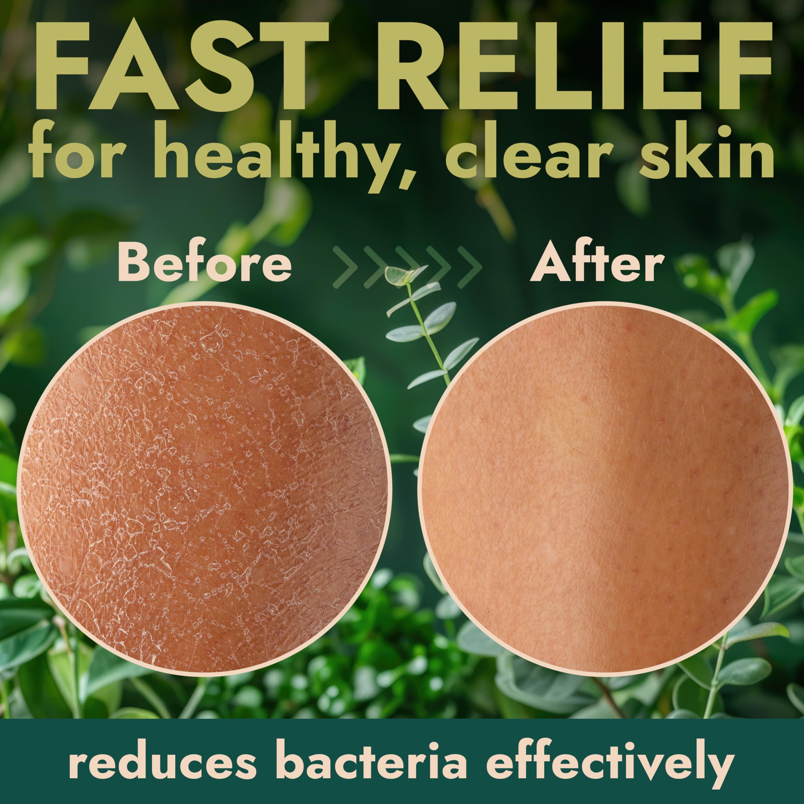 Antibacterial Body Wash & Scrubber – Back Acne & Odor Relief