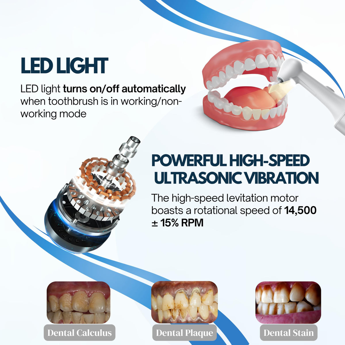 Ultrasonic Electric Teeth Polisher - Premium Selection Official Imagery - 6