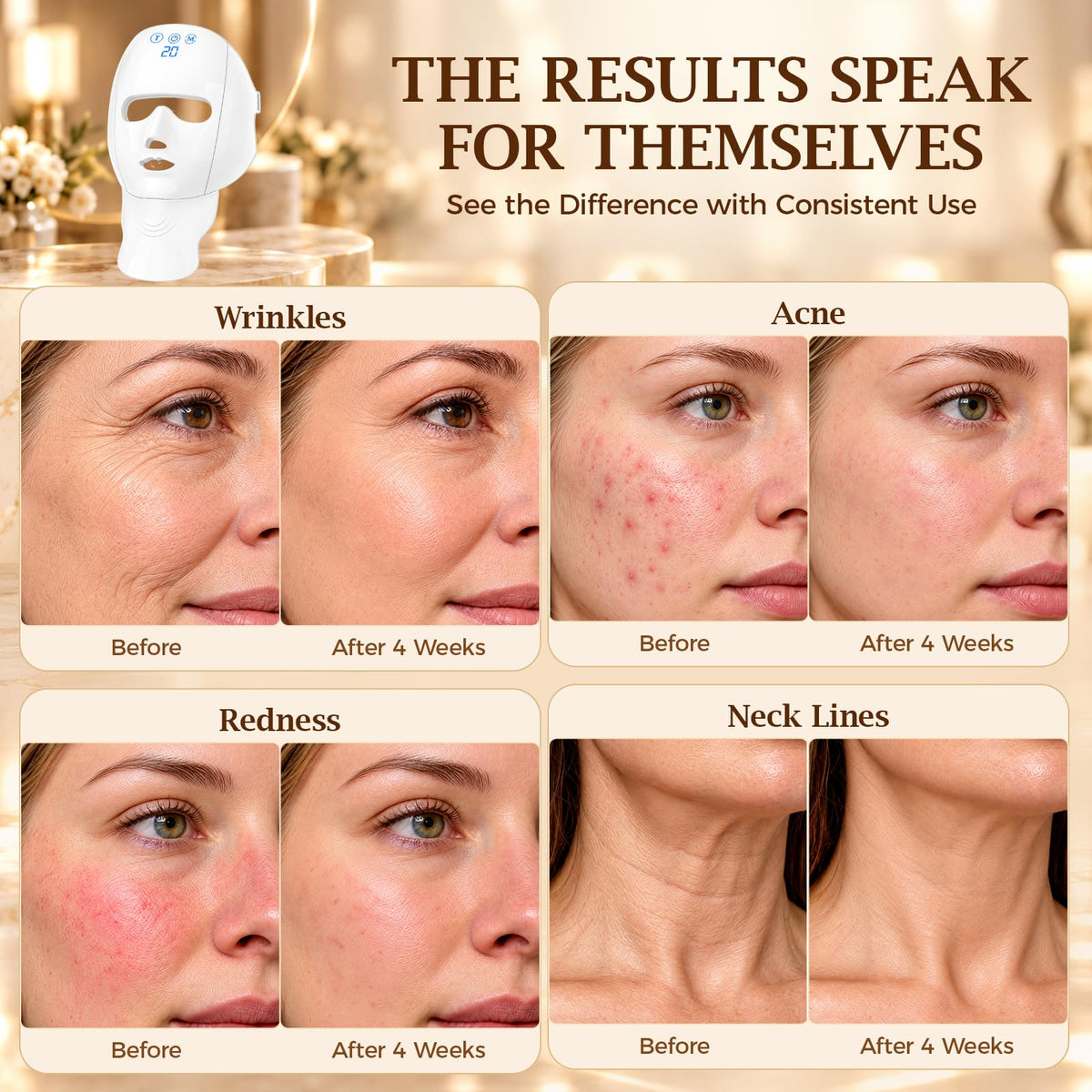 Wireless Red Light Therapy Mask for Face and Neck LED Red - Qoyapow Official Imagery - 4